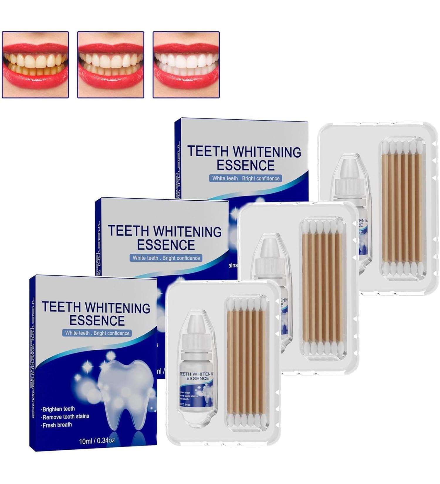 Powerful Teeth Whitening Serum Effectively Removes Surface Plaque Powerful Teeth Whitening Serum Teeth Whitening Serum Removes Various Stains - Buy Online on GoSupps.com