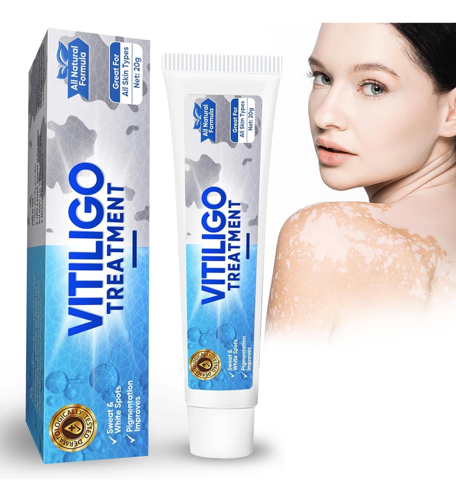 Effective Vitiligo Treatment Cream | Restore Skin Pigmentation & Reduce Fading - Buy Online on GoSupps.com