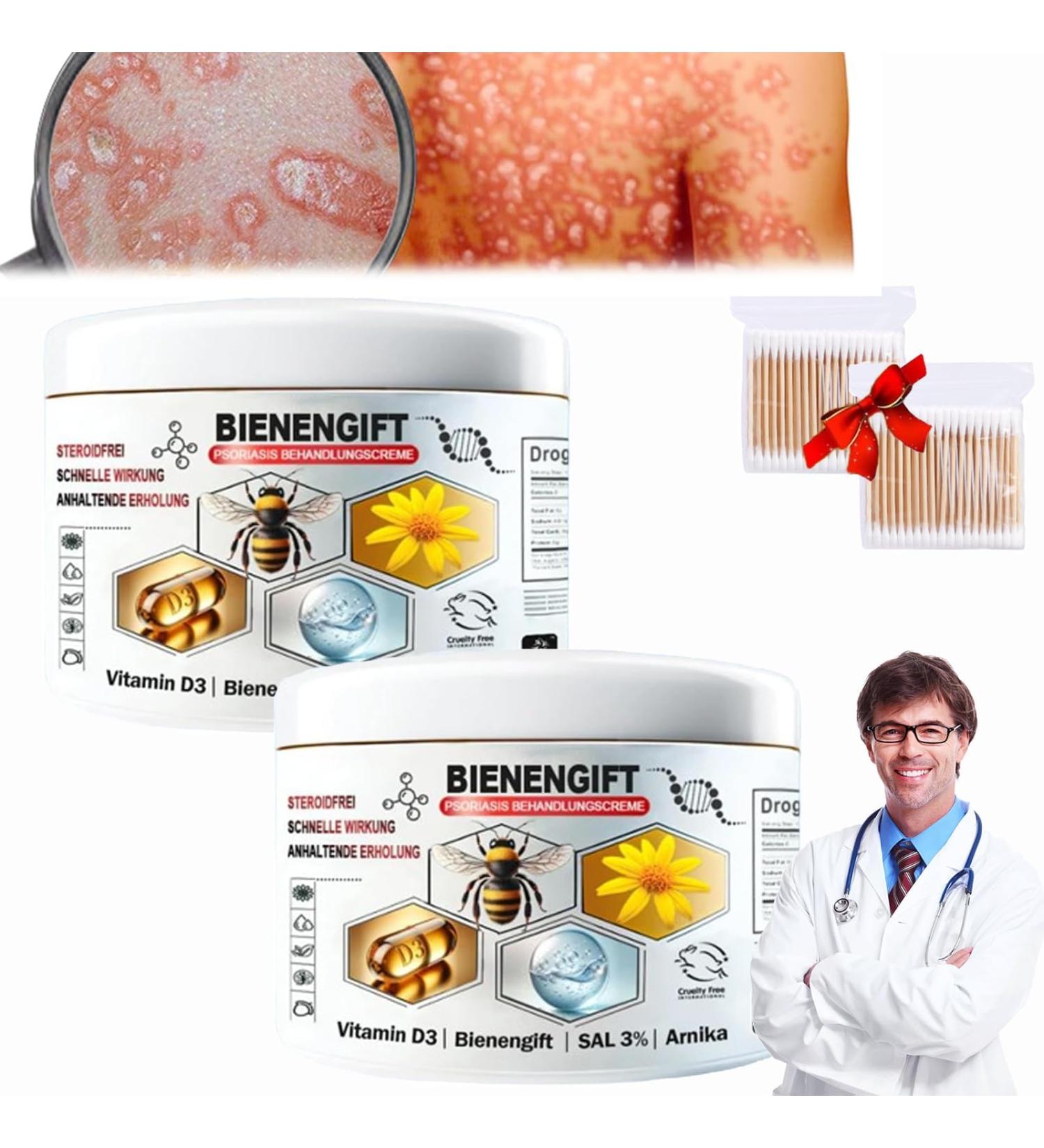 Buy Todahof Bienengift Psoriasis Treatment Cream - Effective Pain Relief & Healing (2 Pieces) - International Shipping Available - Buy Online on GoSupps.com