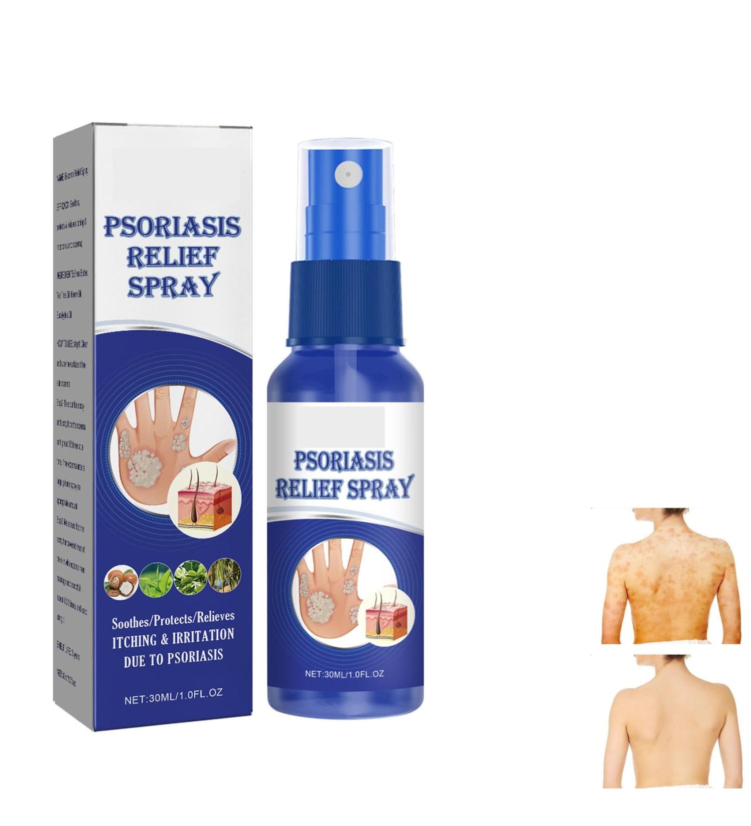 Psoriasis Repair Spray - Herbal Treatment for Plaque Psoriasis - Soothing Relief for Skin - 1pc - Buy Online on GoSupps.com