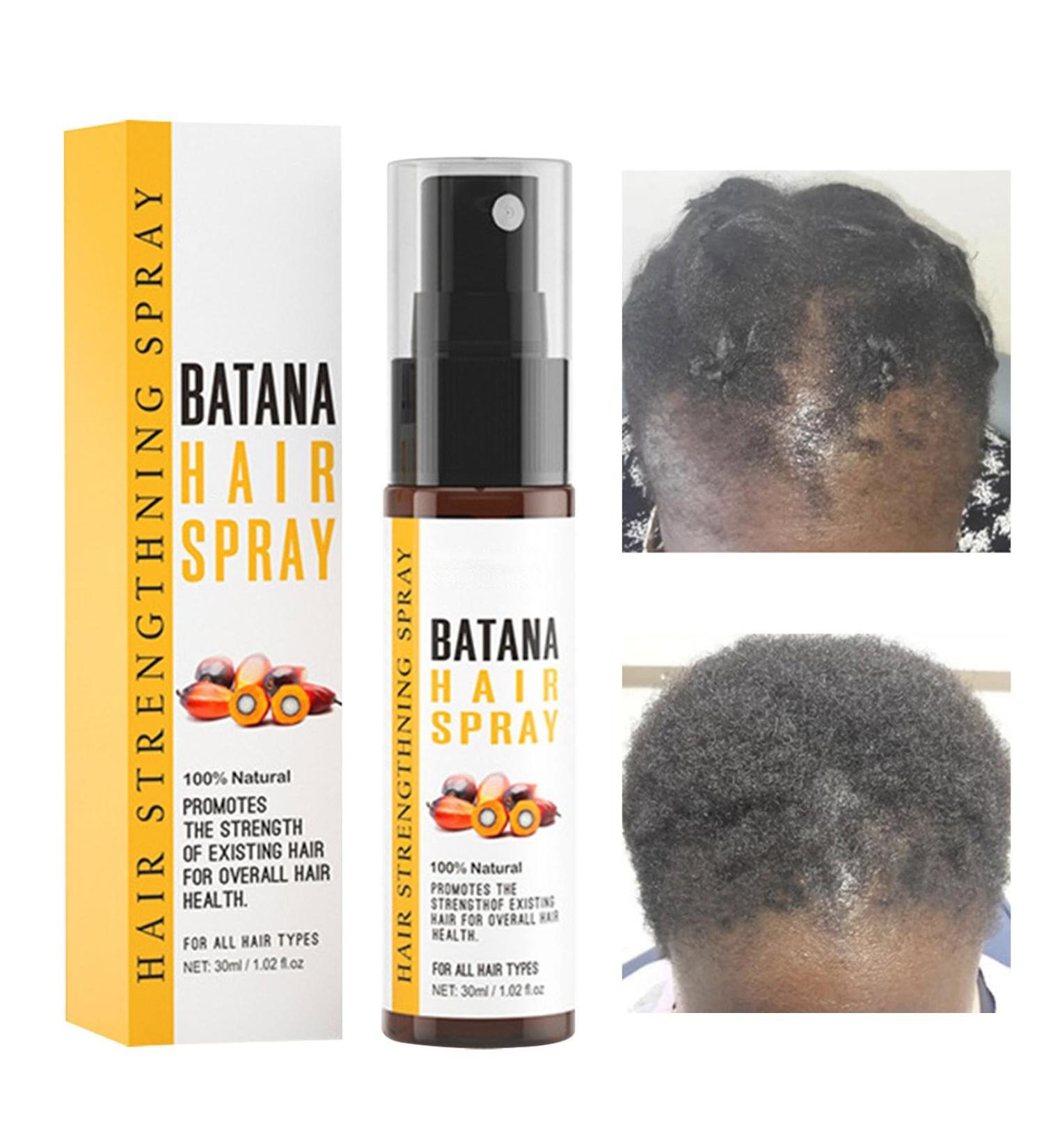 Hair Growth Oil Spray | Healthy Hair Oil Hair Volumizing Spray Hair Batana Oils | 30ml Hair Care Product Promotes Growth Adds Thickness for Women and Men with Damaged Hair - Buy Online on GoSupps.com