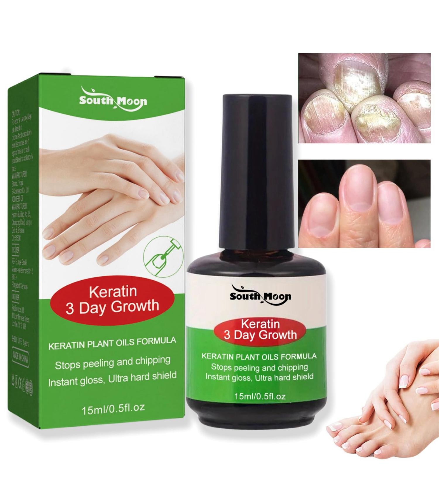 Keratin 3 Day Growth Nail Treatment & Strengthener Nail Growth Treatment for Nail Strengthener Fast Keratin Nail Hardener Nail Repair Treatment for Thin Nails Strengthening Nail Polish Nail Serum - Buy Online on GoSupps.com