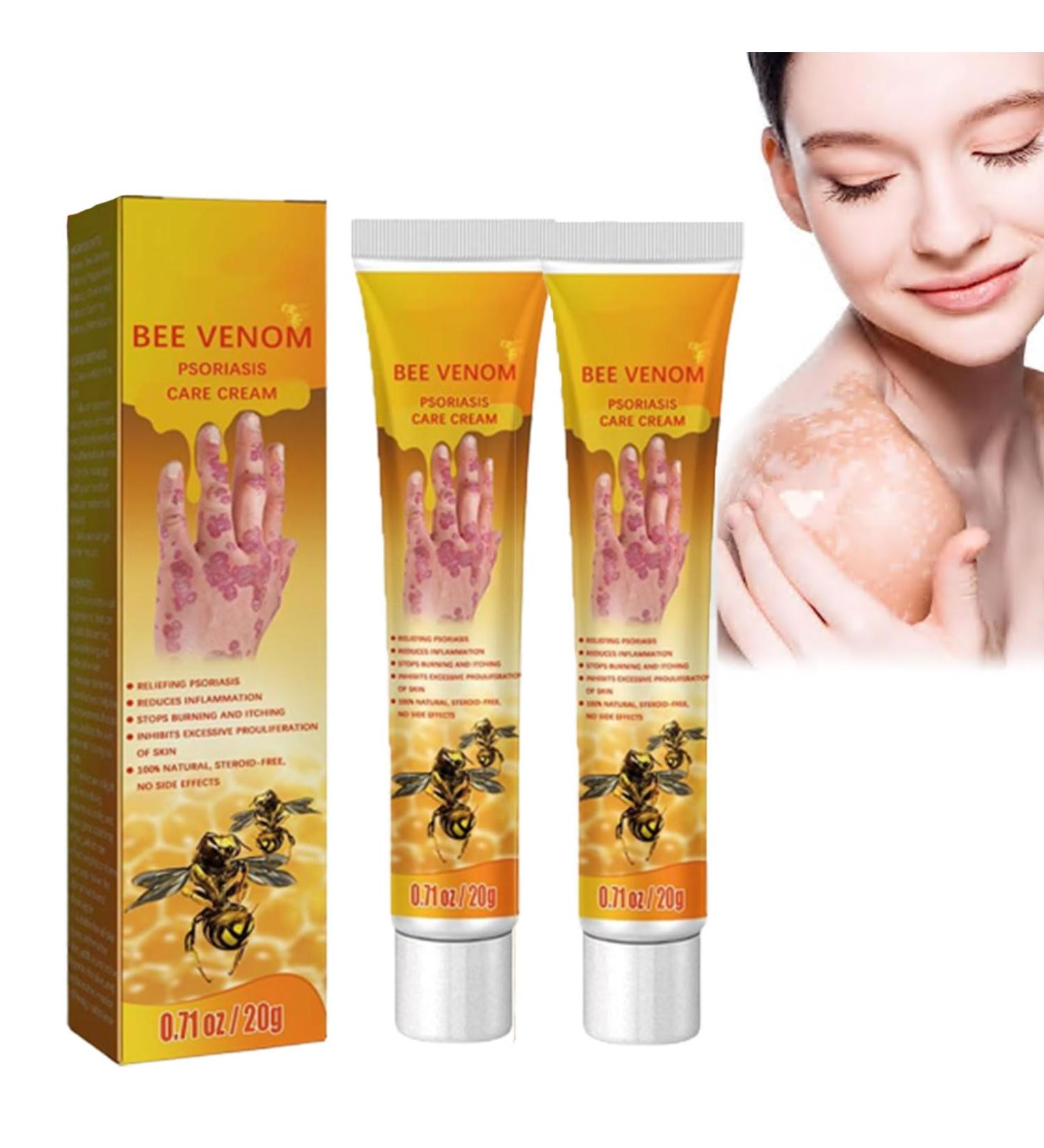 New Zealand Bee Venom Psoriasis Treatment Cream - Anti-Itch Relief (2pcs) - Buy Online on GoSupps.com