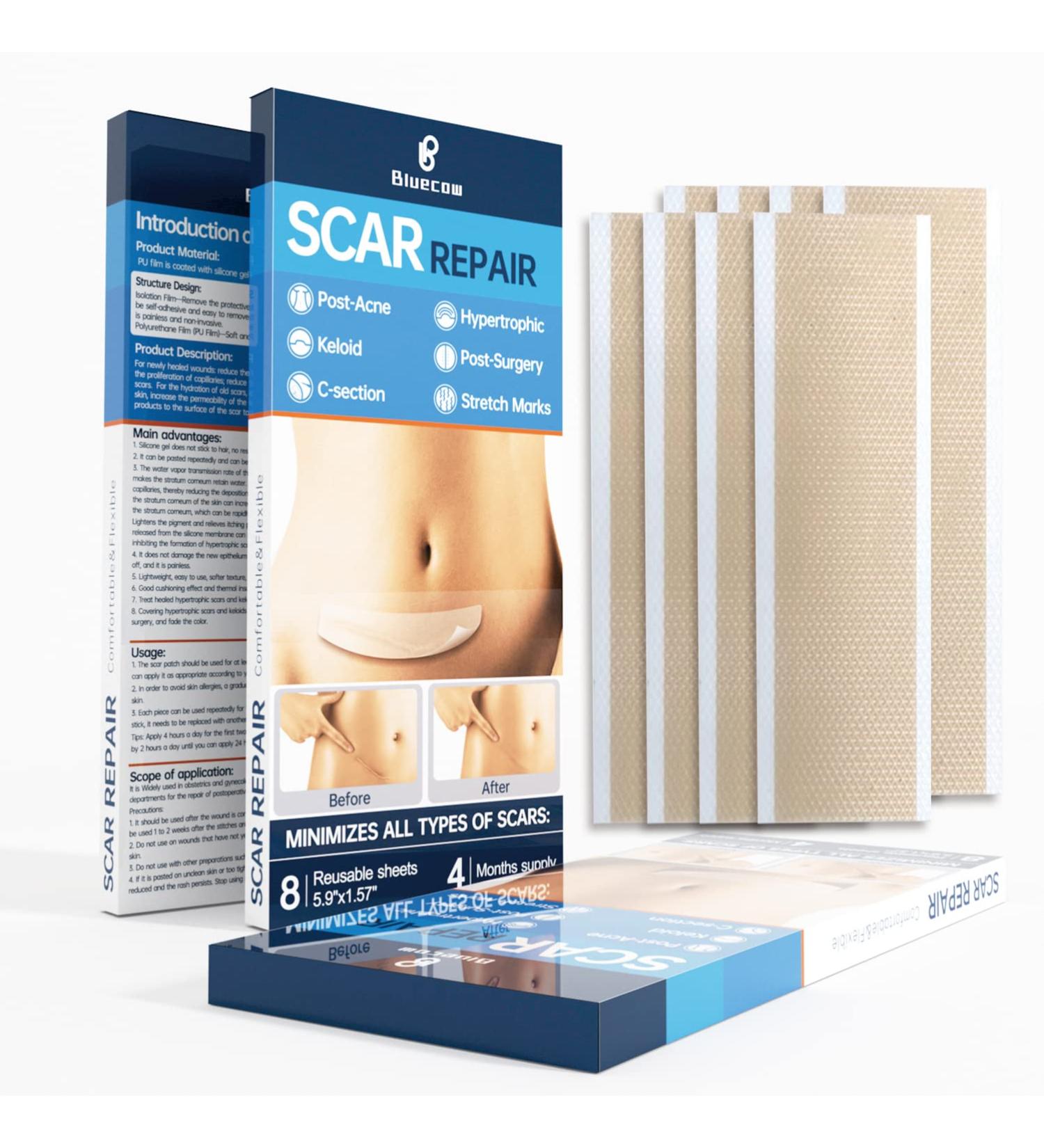 Silicone Scar Sheets 8 Pack - Scar Away Strips for Scars, Keloid, C-Section, Surgical - Reusable Scar Removal Gel Tape - 16 Week Supply - Tummy Tuck Post Surgery Supplies (5.9 x 1.57) - Buy Online on GoSupps.com