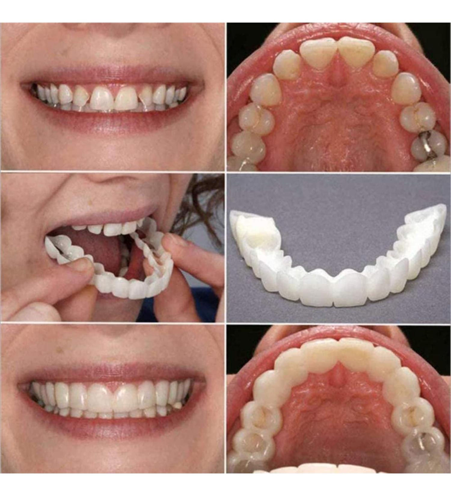 Buy Natural Dental Prosthesis | Immediate False Teeth & Temporary Tooth Facets for Men & Women - Removable Silicone Options - Buy Online on GoSupps.com