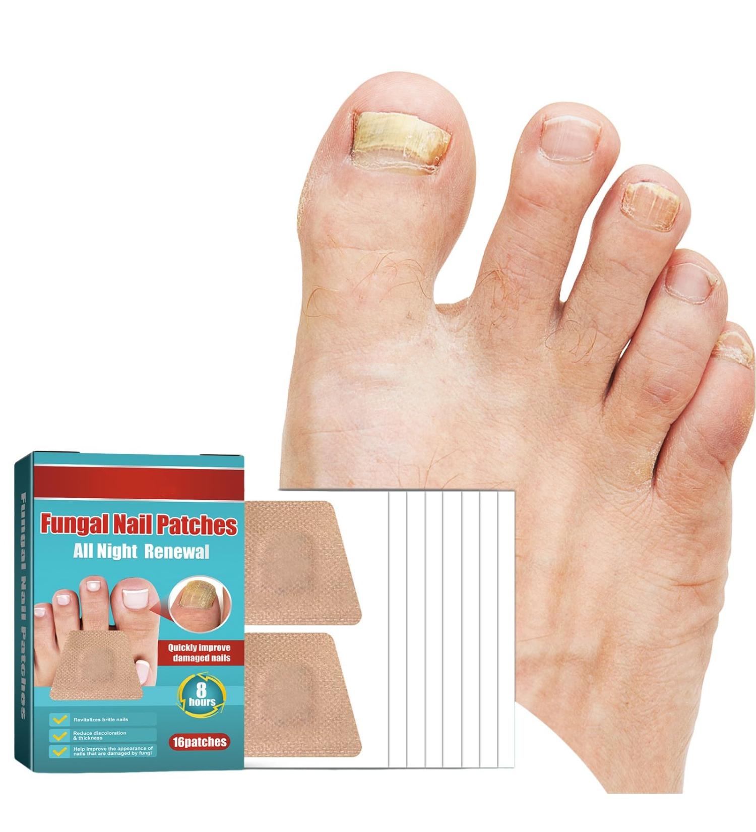 Toe Nail Patches for Fungus - Fast & Effective Nighttime Renewal | 16 Safe Fungal Nail Patches for Ultimate Foot Care - Buy Online on GoSupps.com