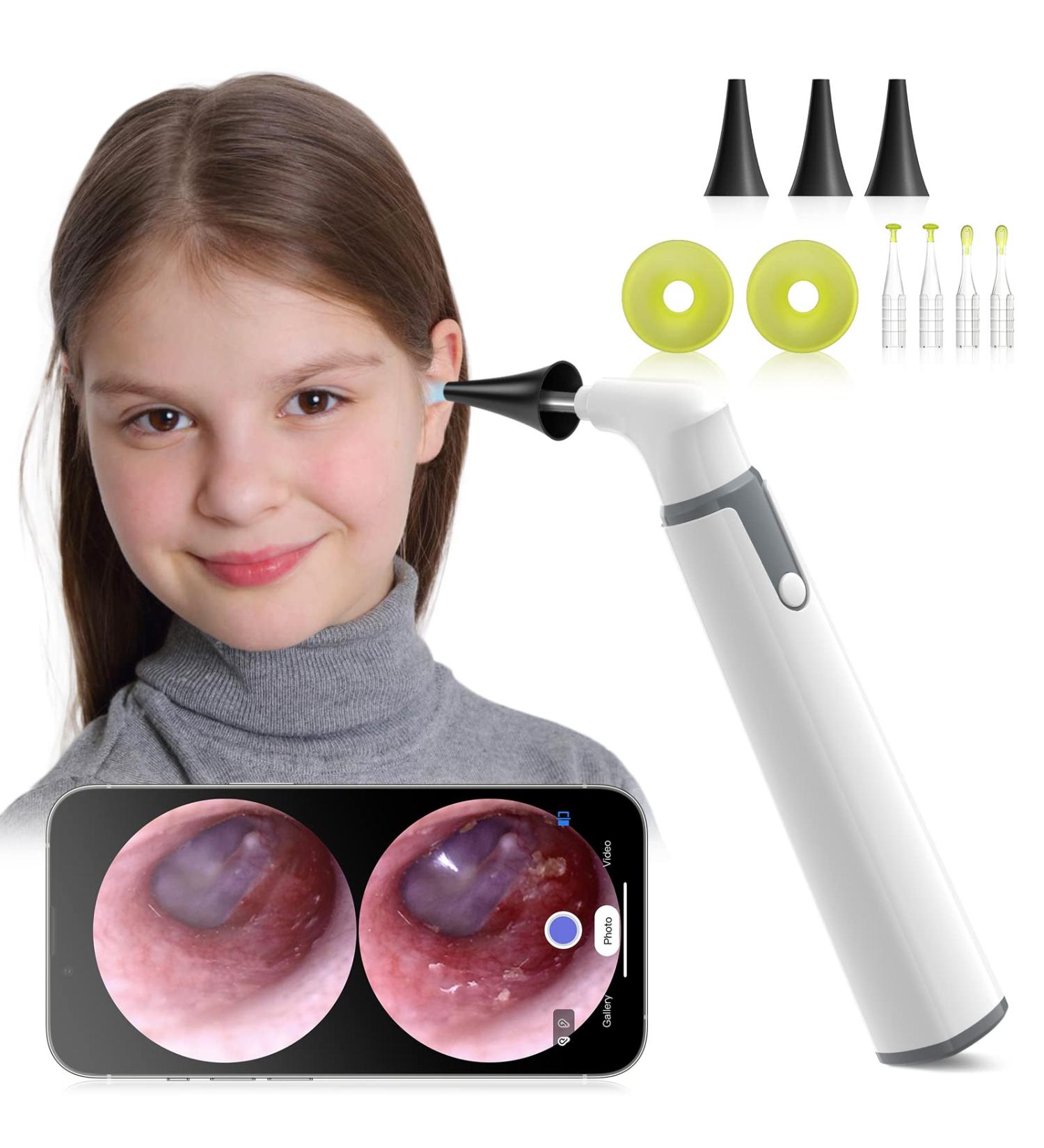 Anykit Wireless Otoscope Ear Camera - Dual View 3.9mm 720PHD WiFi Ear Scope with Ear Wax Removal Tool for Kids, Adults & Pets - Compatible with Android and iPhone - Buy Online on GoSupps.com