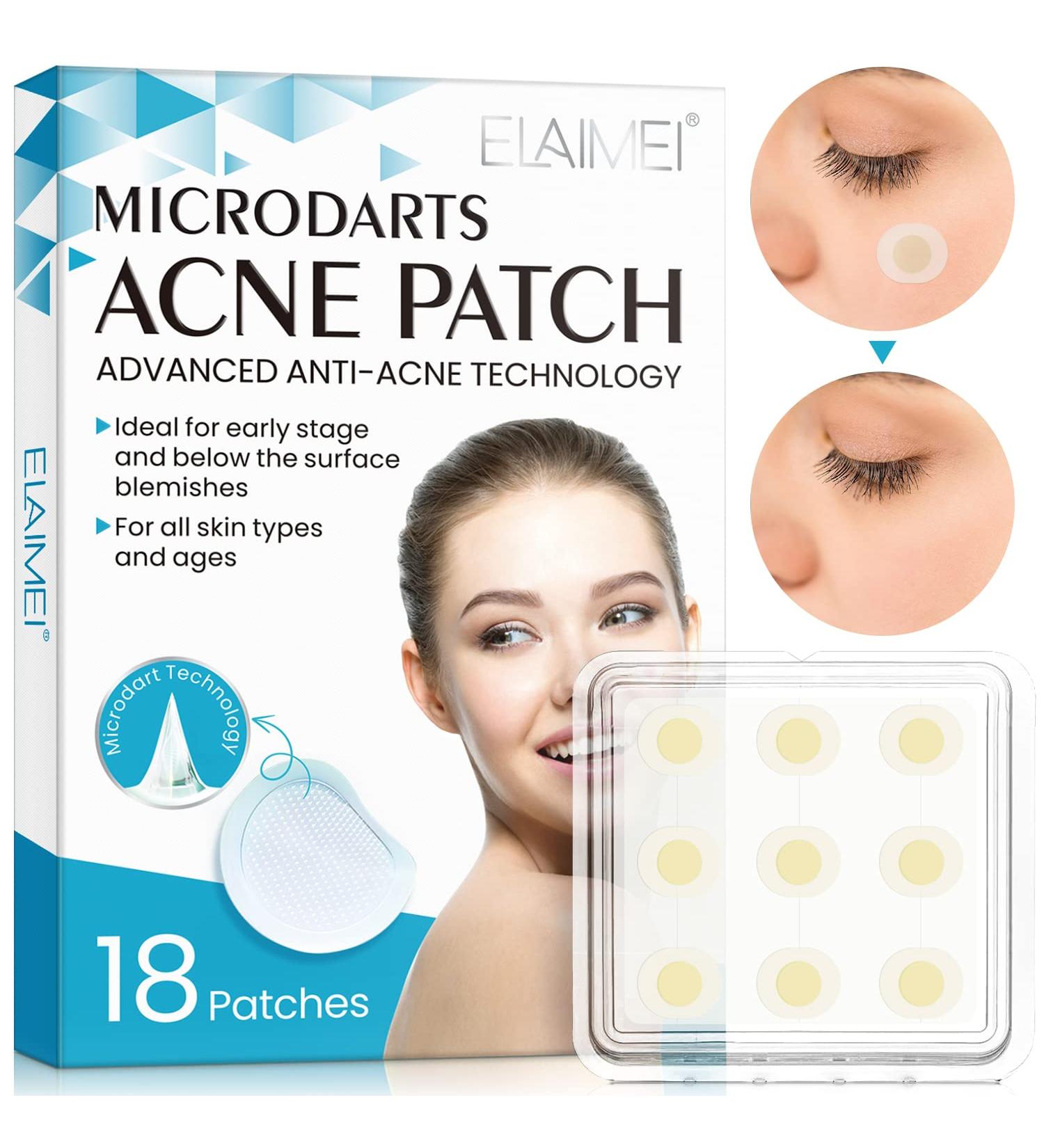 Jonov Acne Pimple Patch - Fast Acting Hydrocolloid Pimple Patches for Night - 18 Blemish Cover Stickers for Face - Buy Online on GoSupps.com