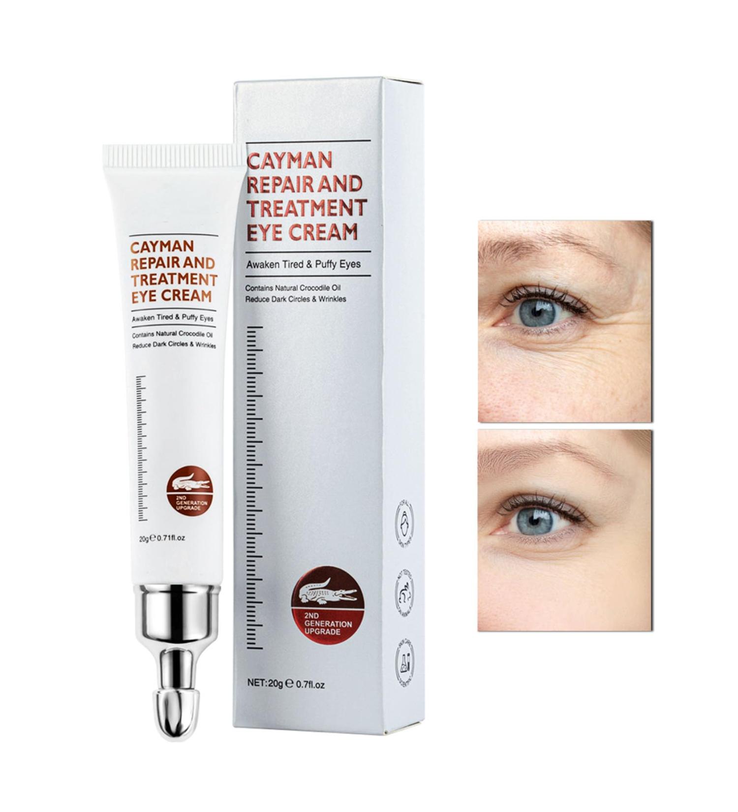 CAHIUYOA Eye Cream for Dark Circles and Puffiness Firm That Delicate Skin Under Your Eyes - Buy Online on GoSupps.com