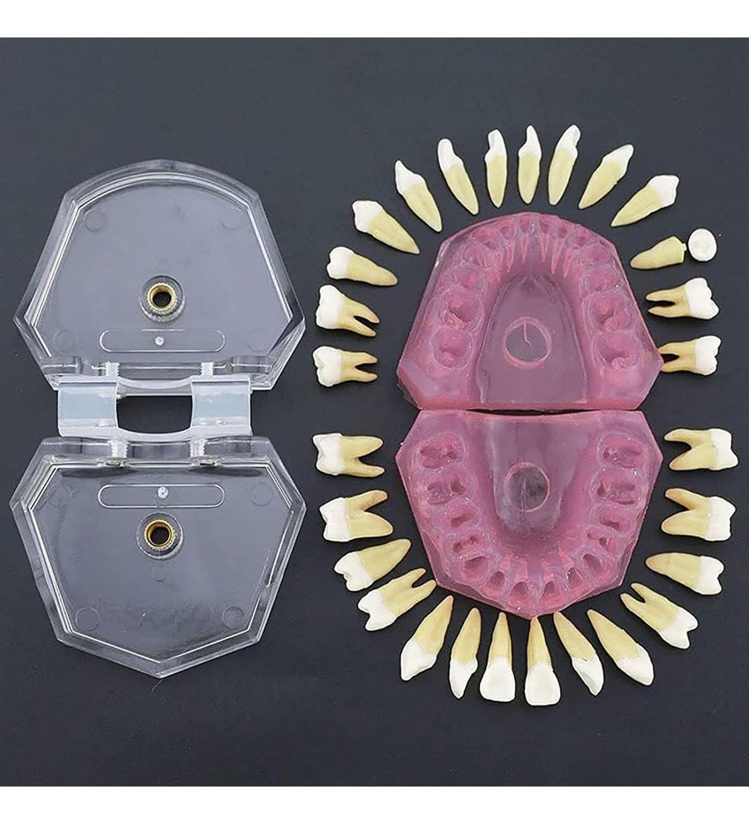 Nvivn Oral Implant Practice Model | Dental Training & Research Tool for Global eCommerce - Buy Online on GoSupps.com