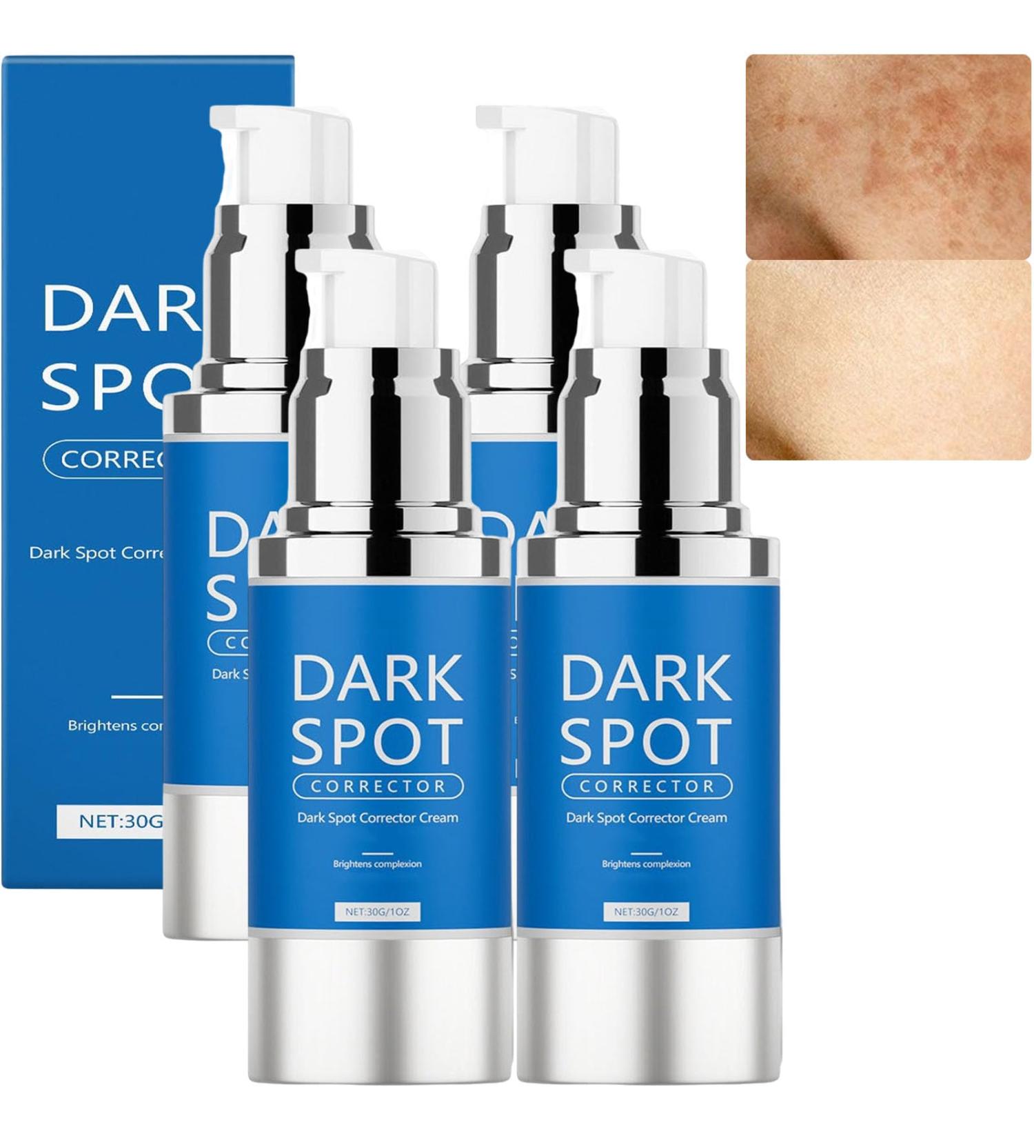  JASUBAI Dark Spot Corrector Face and Body Cream - Brightening serum with niacinamide and hyaluronic acid fades sun spots age spots and freckles - Buy Online on GoSupps.com
