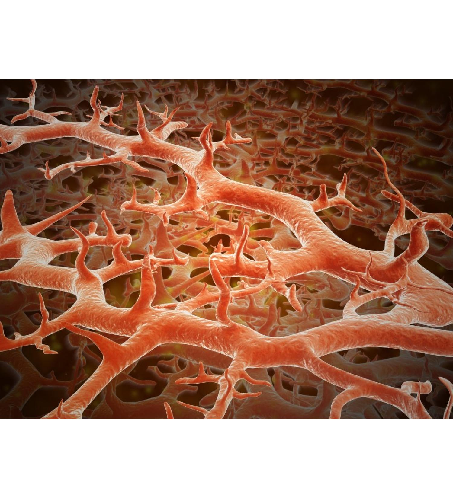 Posterazzi Microscopic view Athlete's fungus also known as ringworm of the foot and tinea pedis is a fungal infection of the skin Poster Print (32 x 24)