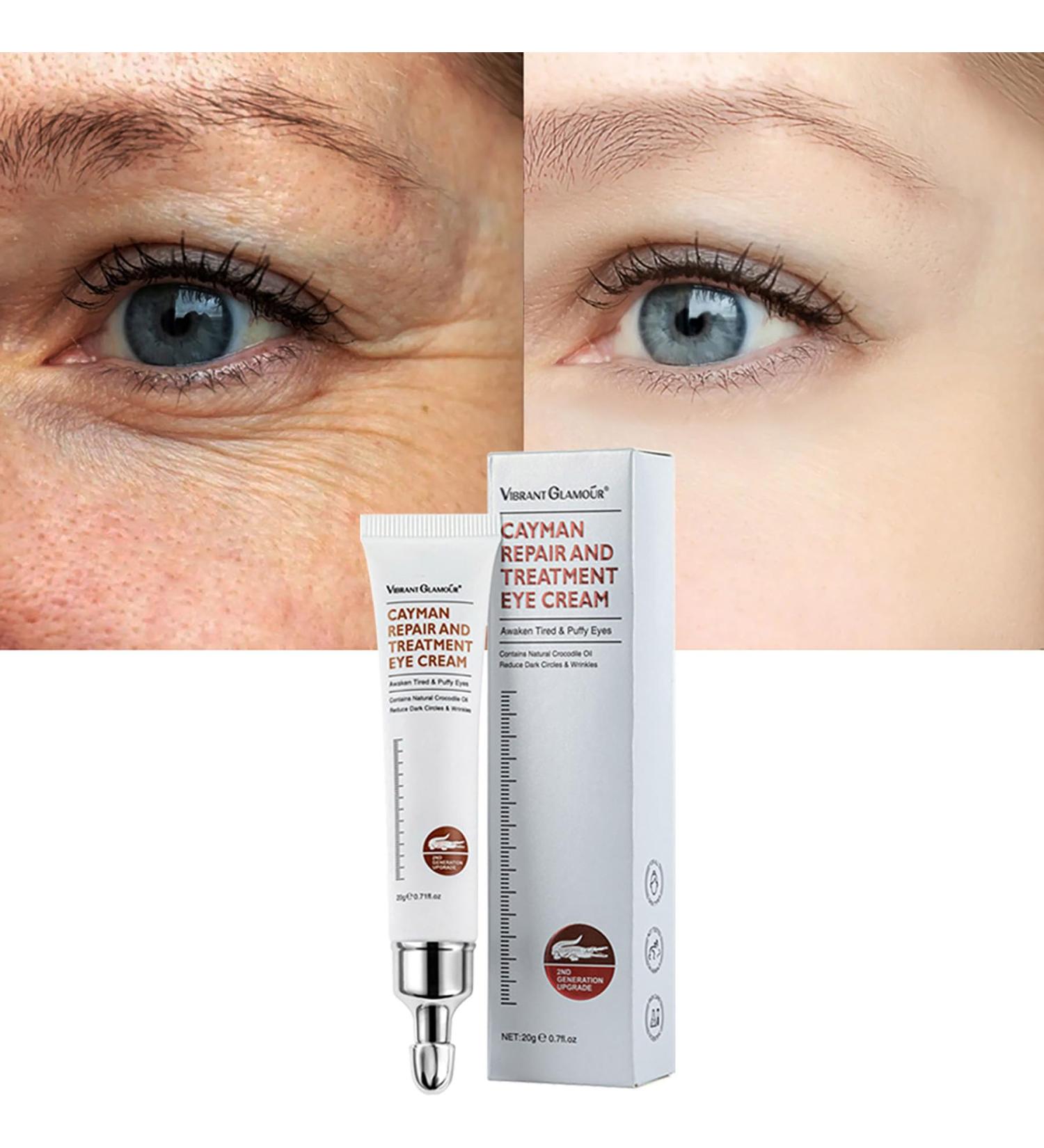 Magic Eye Cream - Instantly Remove Under Eye Bags Wrinkles Puffiness Dark Circles & Fine Lines | Anti-Aging Solution for Men & Women - Buy Online on GoSupps.com
