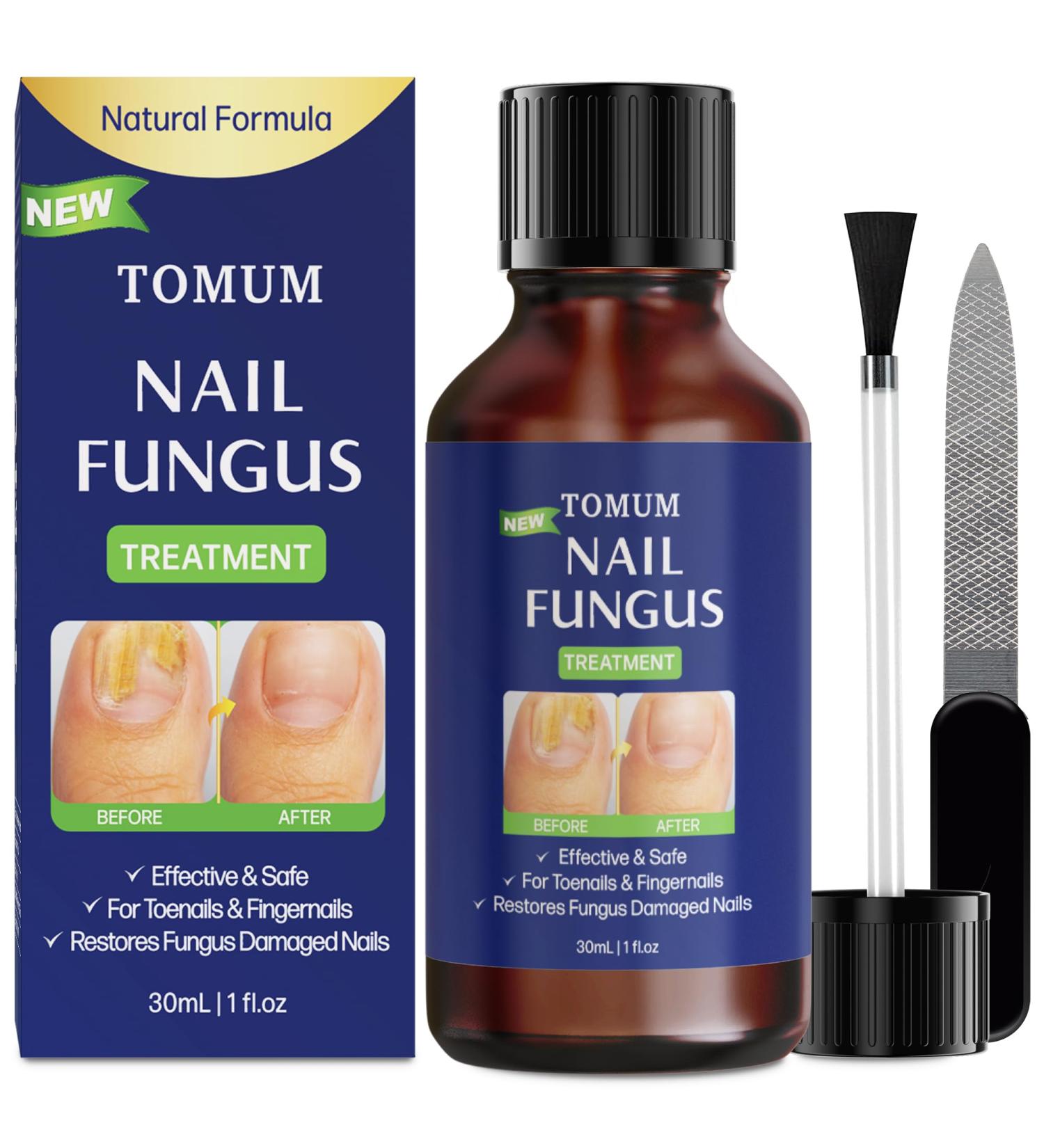 Fungal Toe Nail Treatment - Extra Strength Liquid for Men & Women | Hongos Fungus Remover - Home & Travel Use (30ml/1fl oz - Buy Online on GoSupps.com