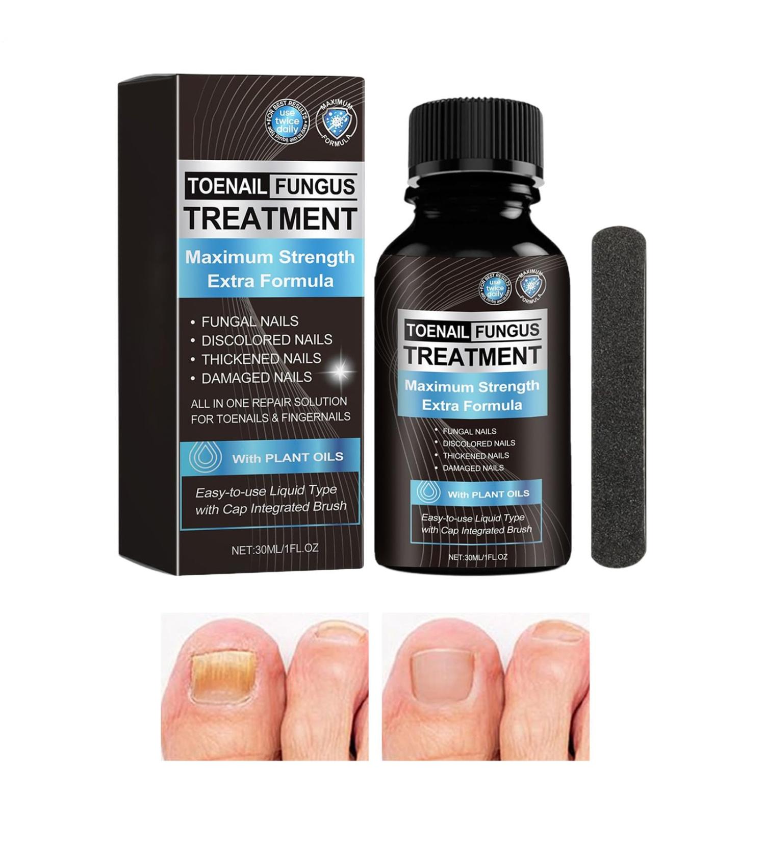 Cracked Toenail Repair Nail Nourishing Solution 30ml Nourishing Fingernail Repair Solution for Bathing Daily Travel Pedicure Manicure Overnight at Home - Buy Online on GoSupps.com