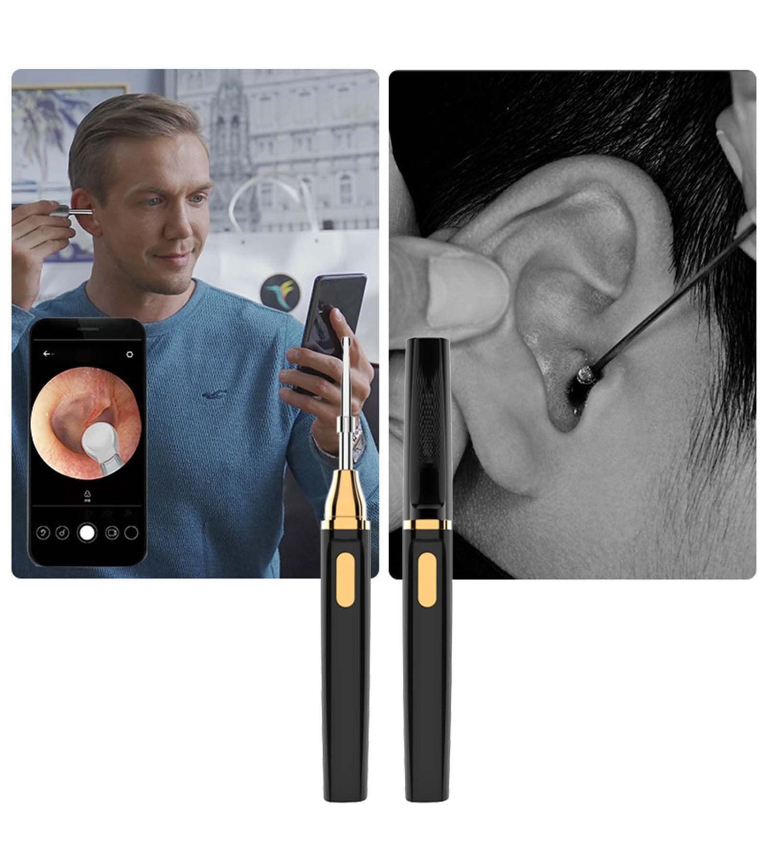 SHILONG Ear Wax Removal Tool with Camera - Earwax Removal Kit for iOS & Android - Buy Online on GoSupps.com