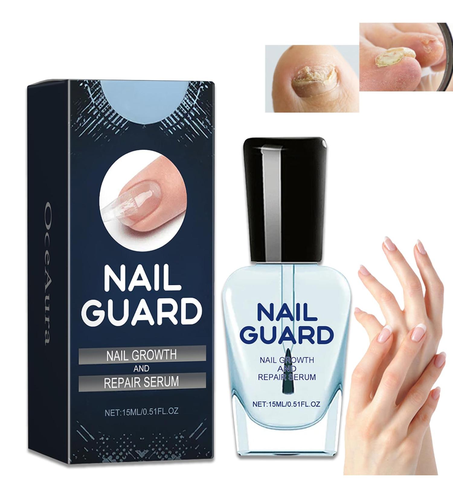 Onyxoguard Nail Growth and Repair Serum Onyxoguard Nail Growth Serum Nail Strengthener and Growth Cuticle Oil Onyxoguard Nail Repair Serum for Thin Nails and Growth (1Piece) - Buy Online on GoSupps.com