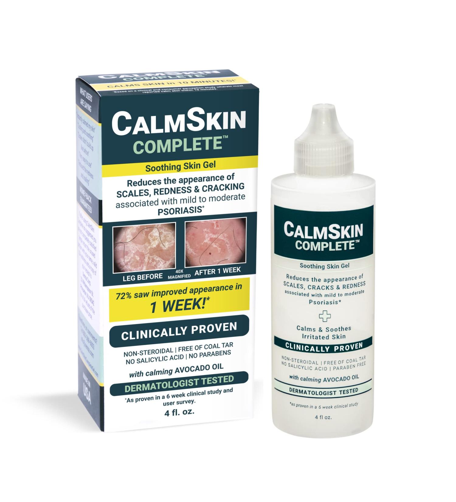 Xenna CalmSkin Complete Gel for Psoriasis Relief | Clinically Proven | Results in 1 Week | Calming Formula | 4 fl. oz - Buy Online on GoSupps.com