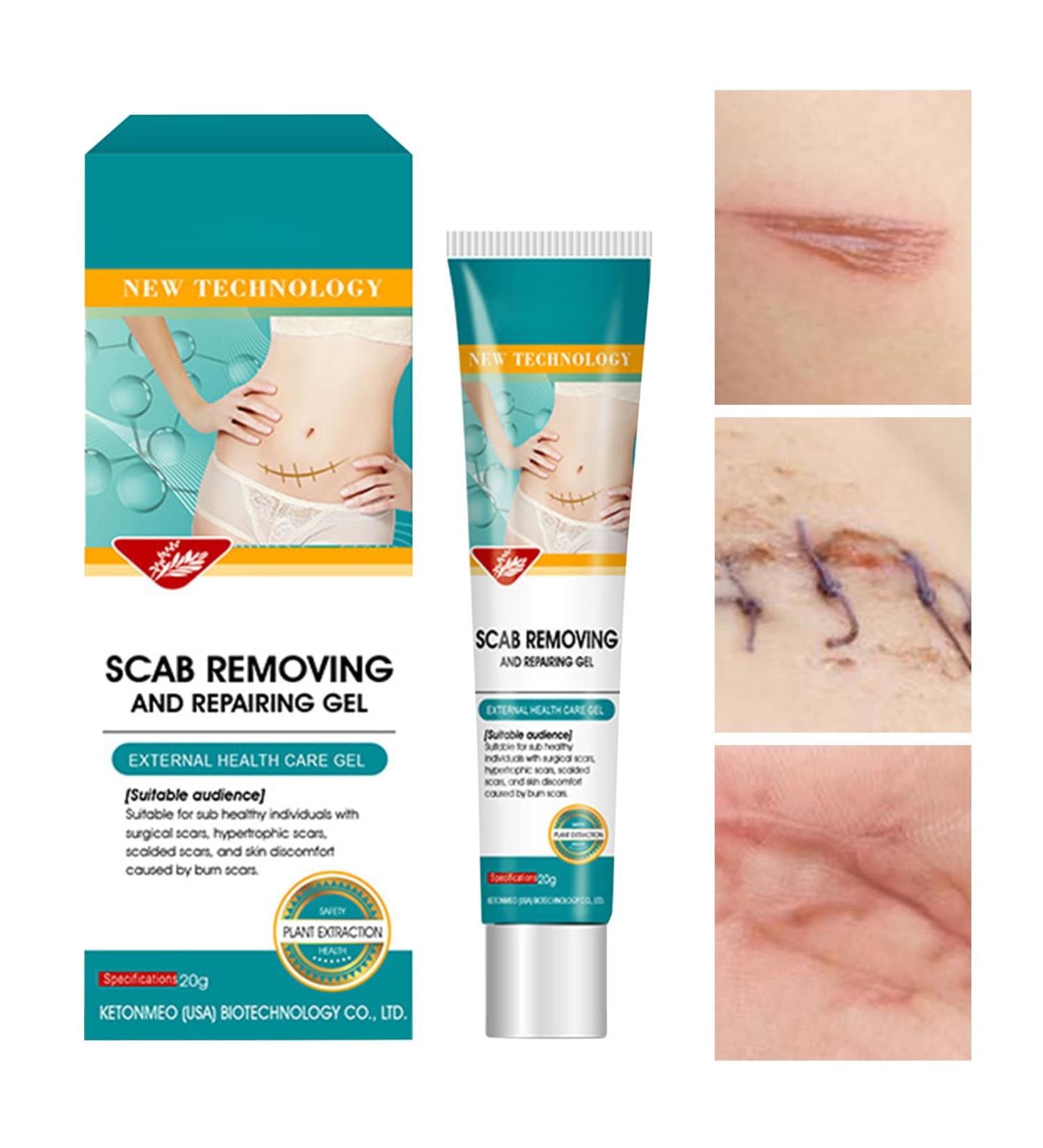  Pruojhw Anti-Scar Gel | 20g Treatment Gel for Wounds Long-Term Care for Scars - For Comfort Recovery Burn Protection and Injury Protection for Home and Body - Buy Online on GoSupps.com
