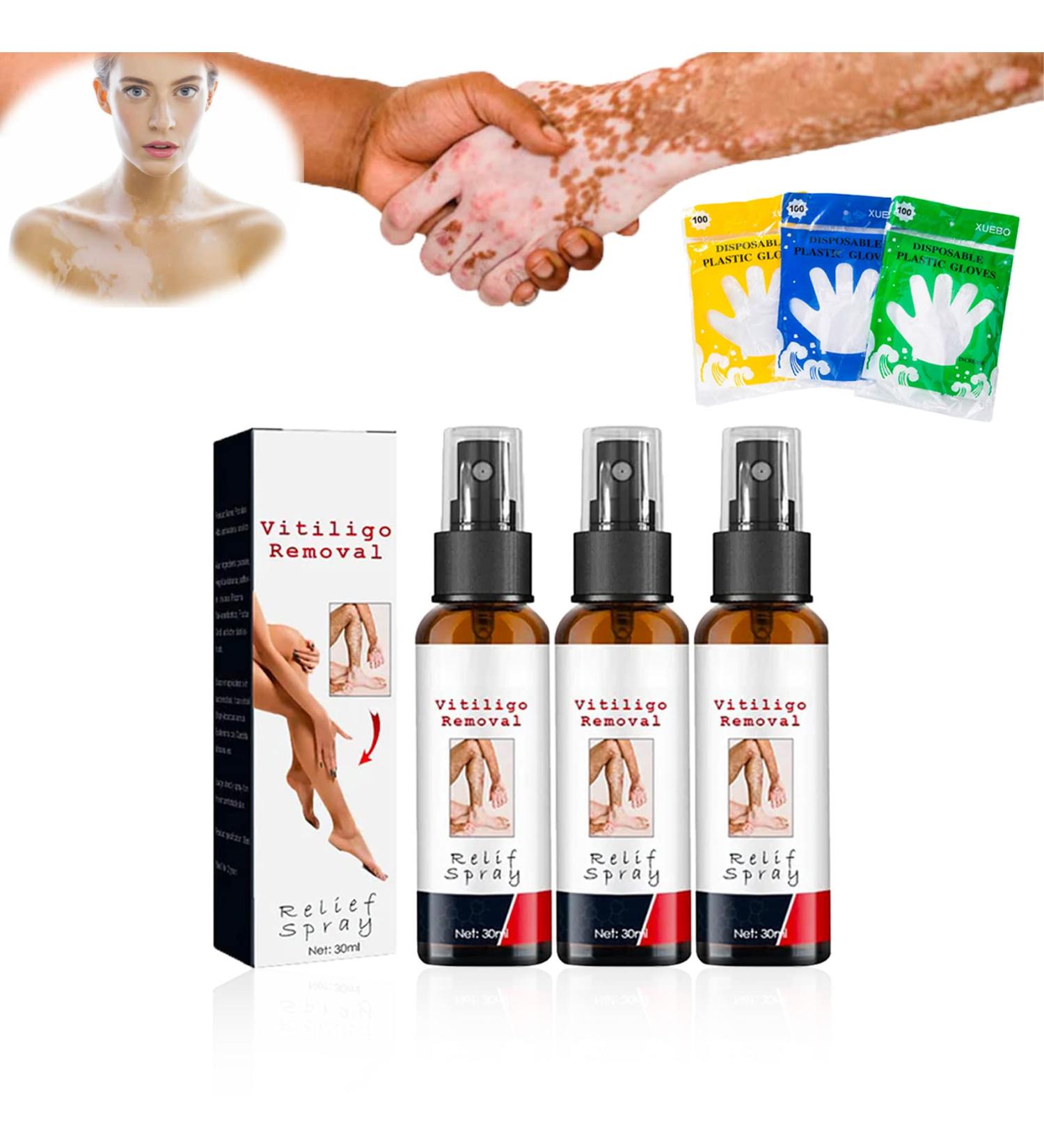 DASHENRAN Vitiligo Removal Relief Spray - White Spot Treatment & Skin Repair (3 pcs) - Buy Online on GoSupps.com