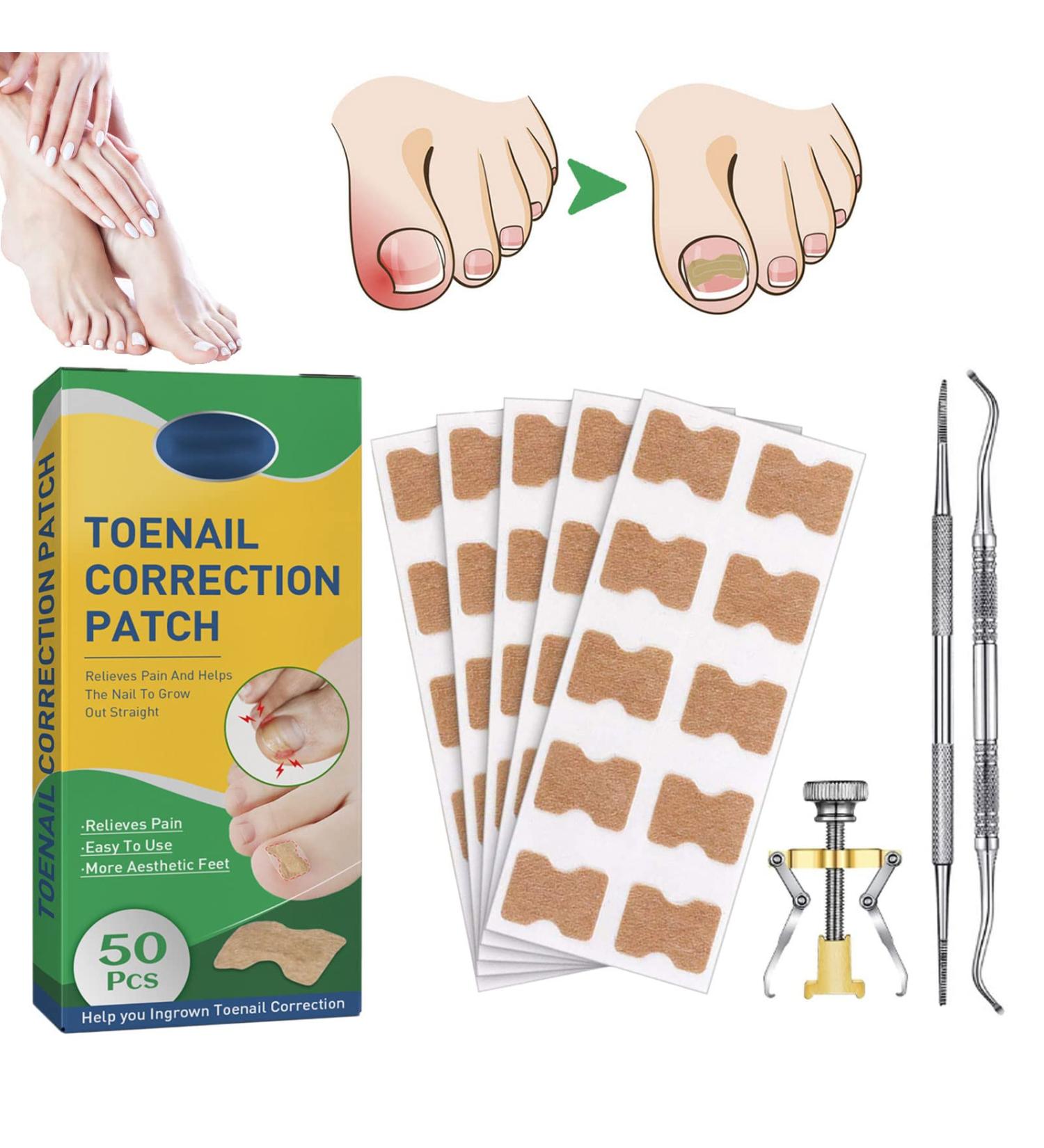 Fitmedify Nail Patches - Toenail Correction Tool for Ingrown Nails, Fungus Relief (50Pcs) - Buy Online on GoSupps.com