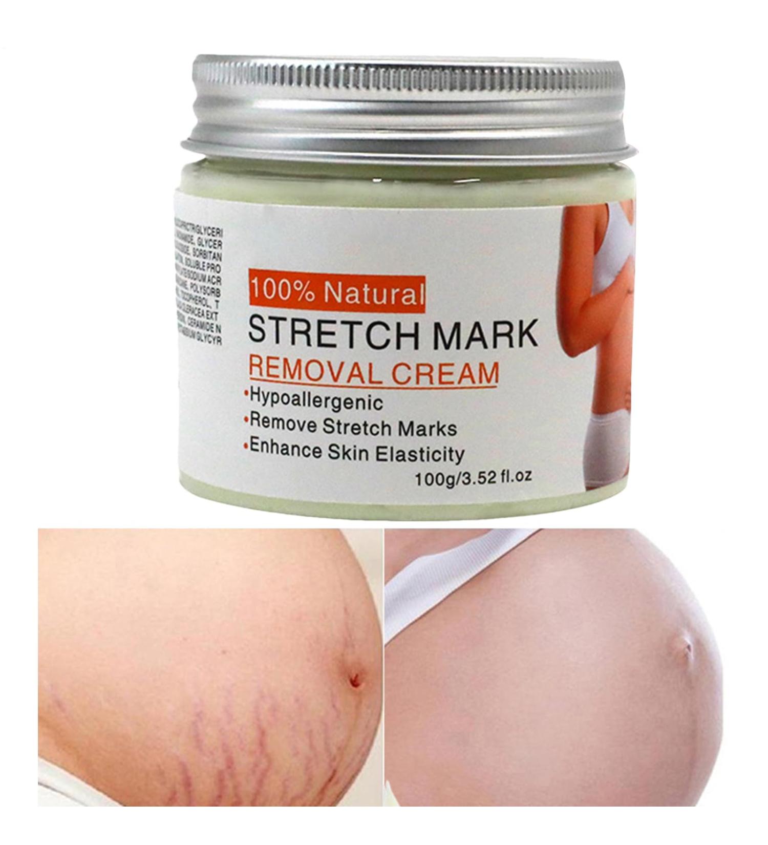 Belly Mark Cream Pregnancy Stretch Mark Lotion Fast Absorbing Formula Smoothing Skin Solution 100g Tube Hydration Excellent for Travel Business Trips Home Use - Buy Online on GoSupps.com