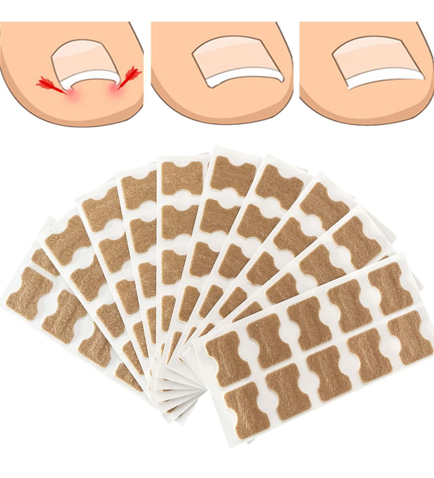 100PCS Ingrown Toe Nail Correction Sticker - Health Toenail Corrector Patch - Buy Online on GoSupps.com