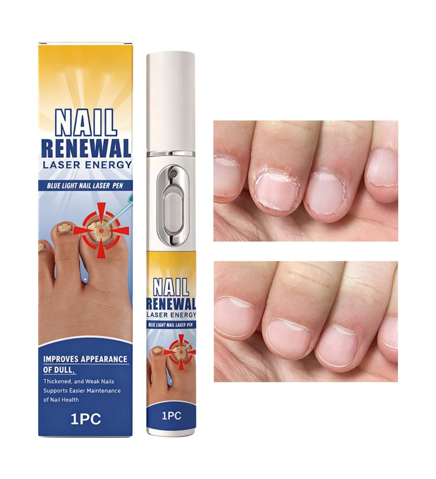 Stylo huile pour cuticules portable 1 pi ce nourriture pr paration des ongles formule absorption rapide pour ongles manucure pr vention des morsures pour femmes - Buy Online on GoSupps.com