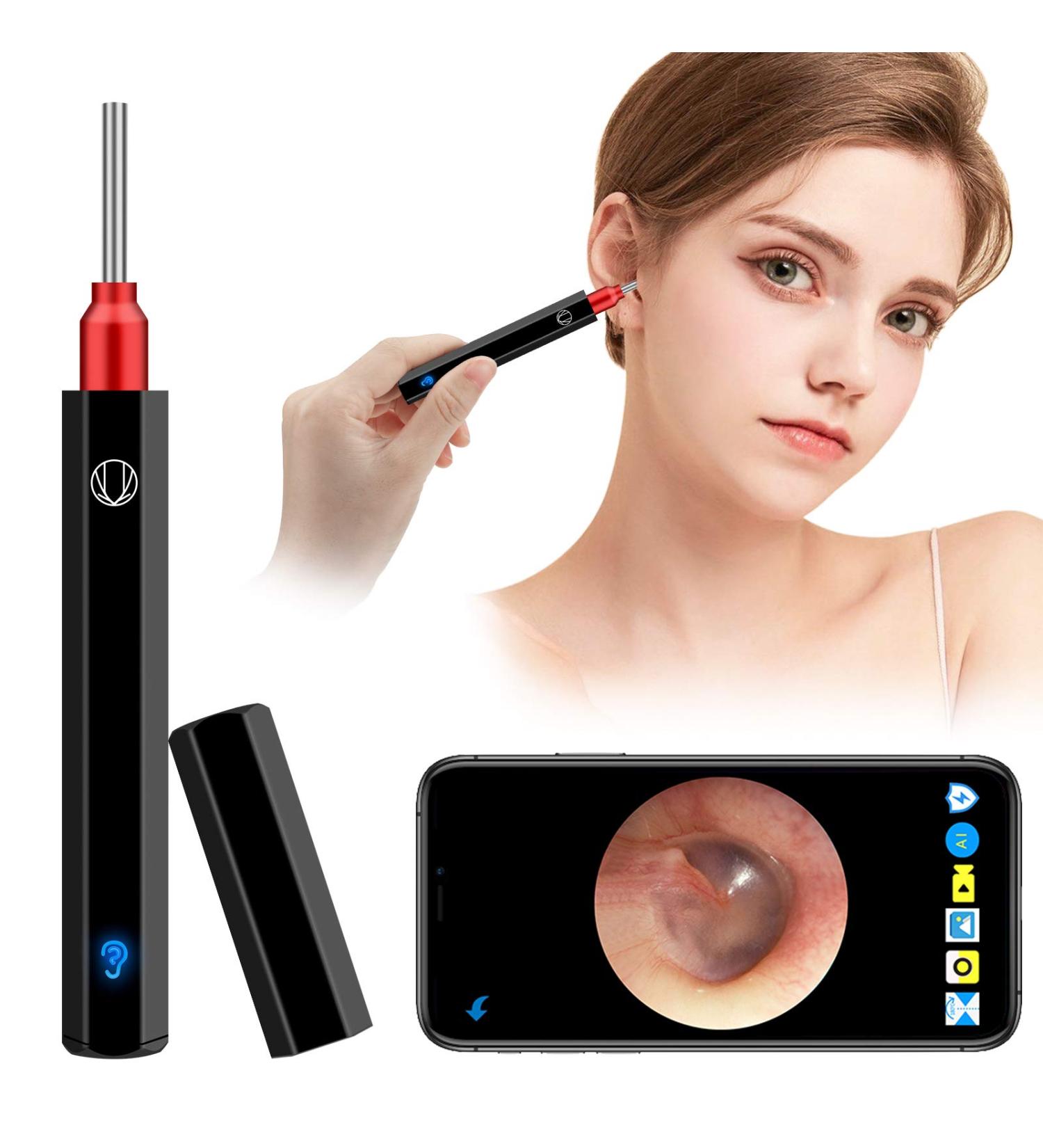 Wireless Otoscope Earwax Removal Tool | 1080P HD WiFi Endoscope for Ear Cleaning | LED Light Ear Scope Camera | Safe Ear Pick Kit for Adults, Kids, Pets | Black Vertical Stripes - Buy Online on GoSupps.com