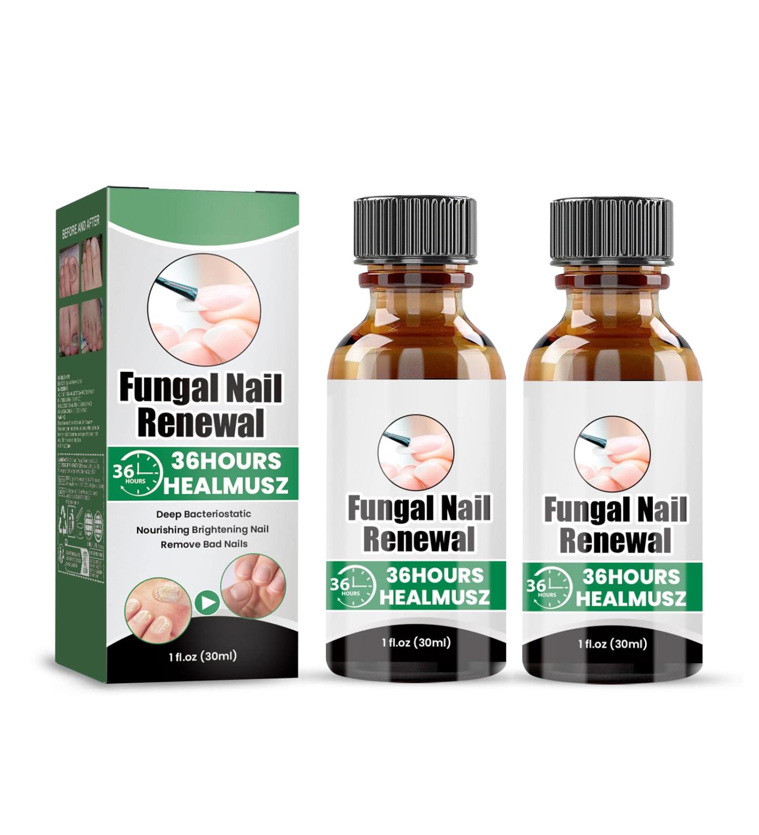 S rum pour ongles - 30 ml x 2 - Huile nourrissante pour les ongles et les cuticules - Traitement des ongles incarn s - Pour ongles craquel s rugueux cassants et fendus - Buy Online on GoSupps.com