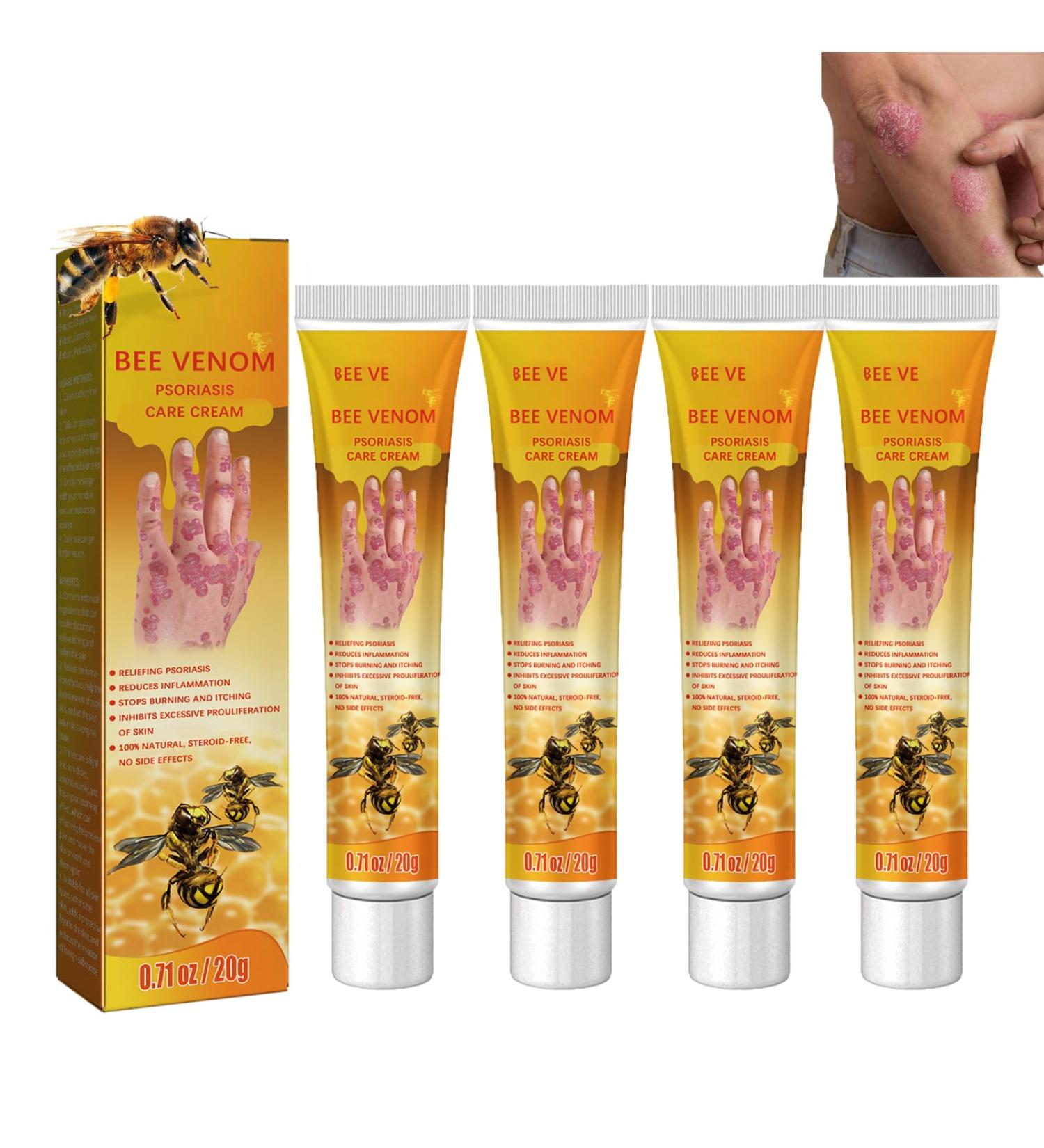 ROKOBN Bee Venom Psoriasis Treatment Cream - Professional Soothing & Moisturizing Skin Relief (4PCS) - Buy Online on GoSupps.com