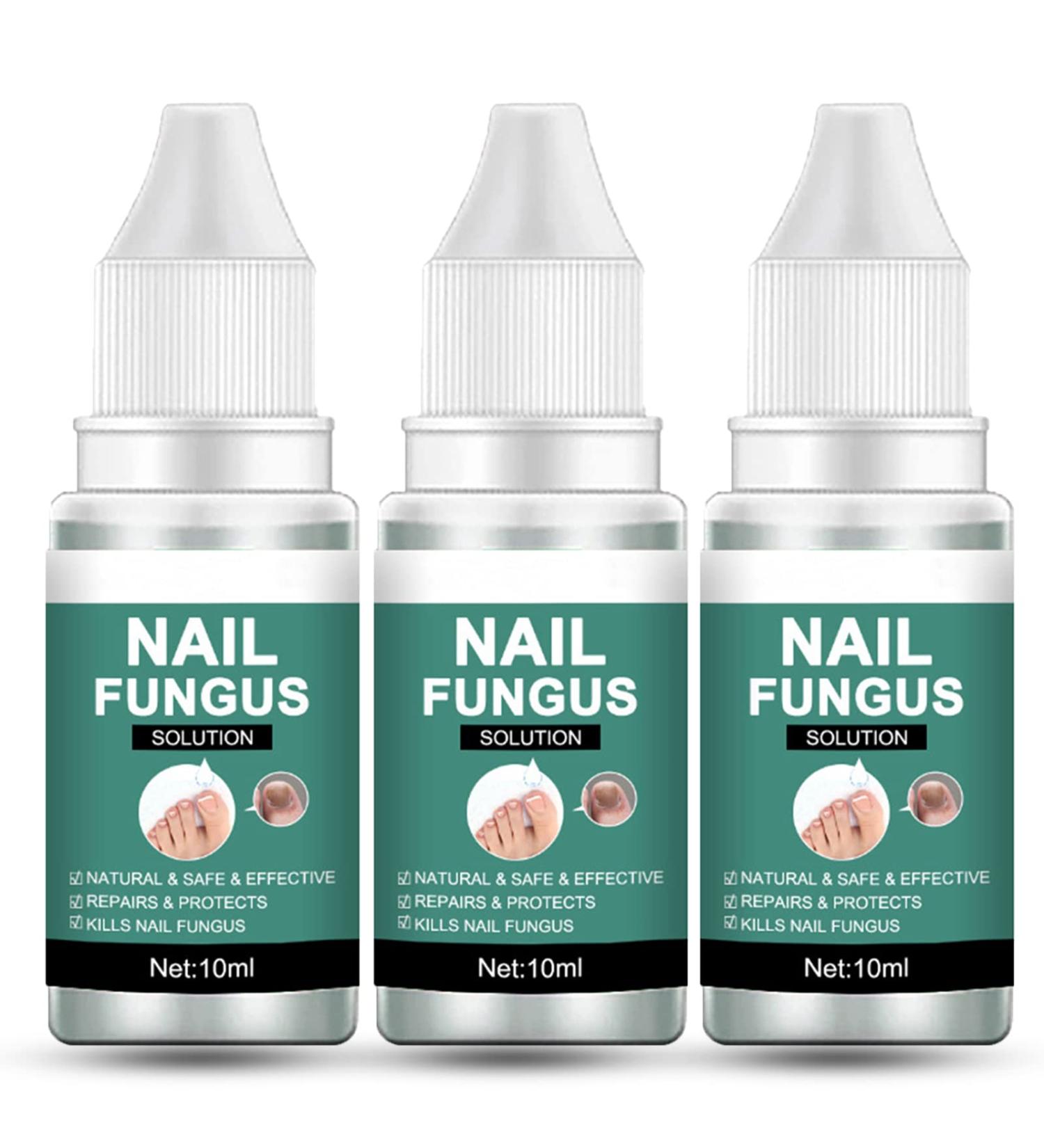 Extra Strong Fungal Nail Treatment for Toenails - Nail Repair Oil for Ingrown Nails - Strengthen and Renew Damaged Nails - 3Pcs Set - Buy Online on GoSupps.com