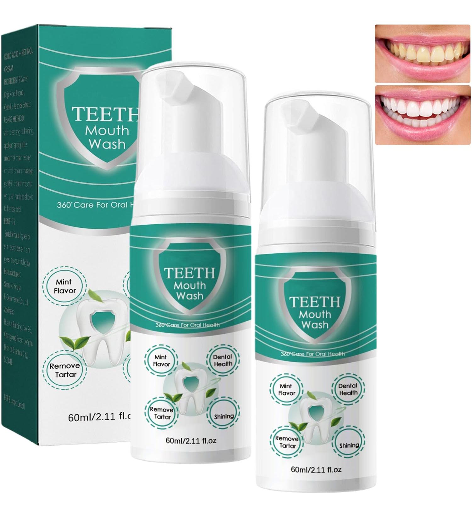 Awzlove Teeth Total Care Mouthwash Natural Mouthwash Whitening Foam Teeth Whitening Foam for Bad Breath Breath Refreshing Deep Cleaning Toothpaste (2 pcs) - Buy Online on GoSupps.com