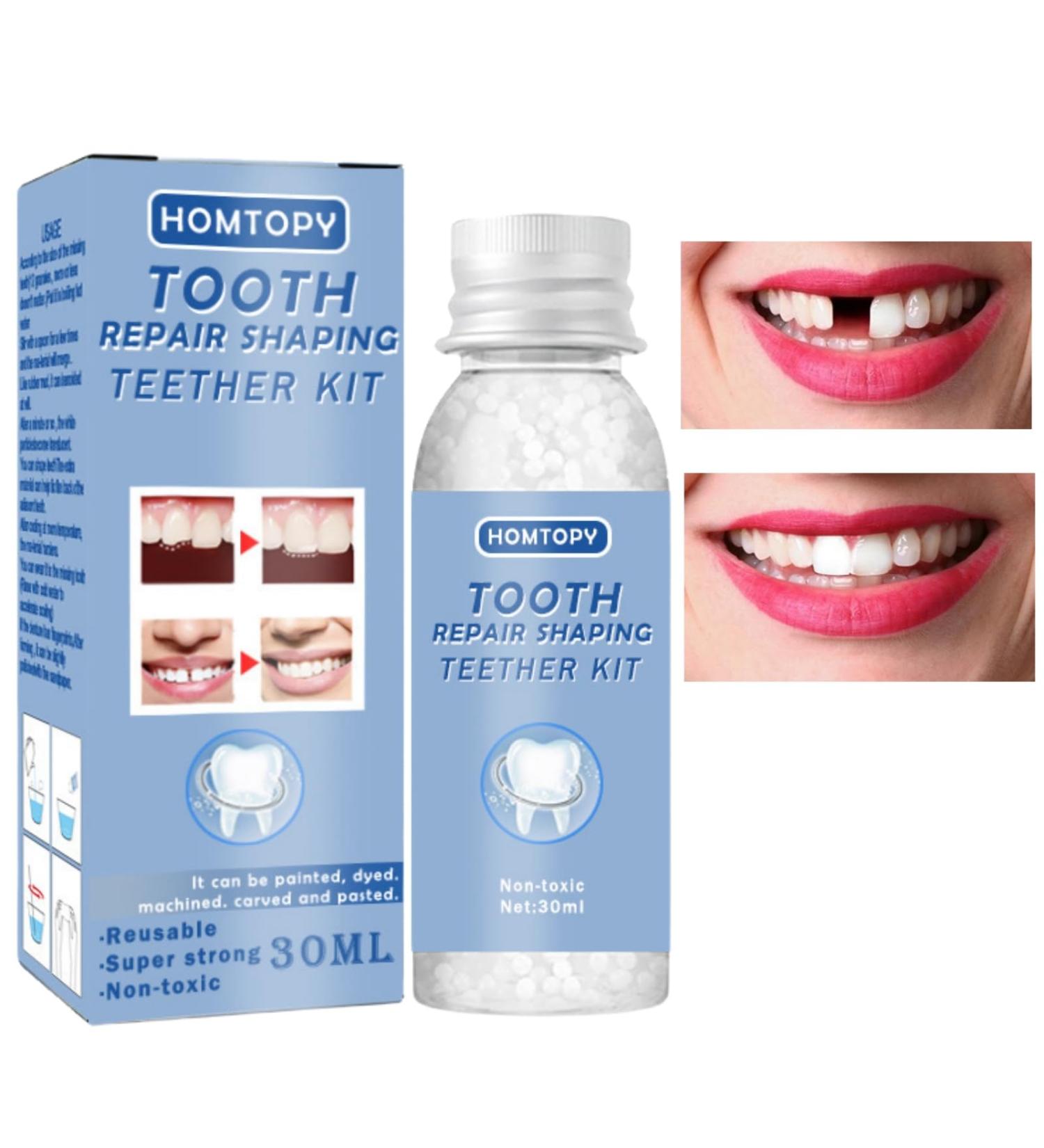 Temporary Tooth Filling Repair Kit - Dental Tooth Filler for Missing or Broken Teeth - Buy Online on GoSupps.com