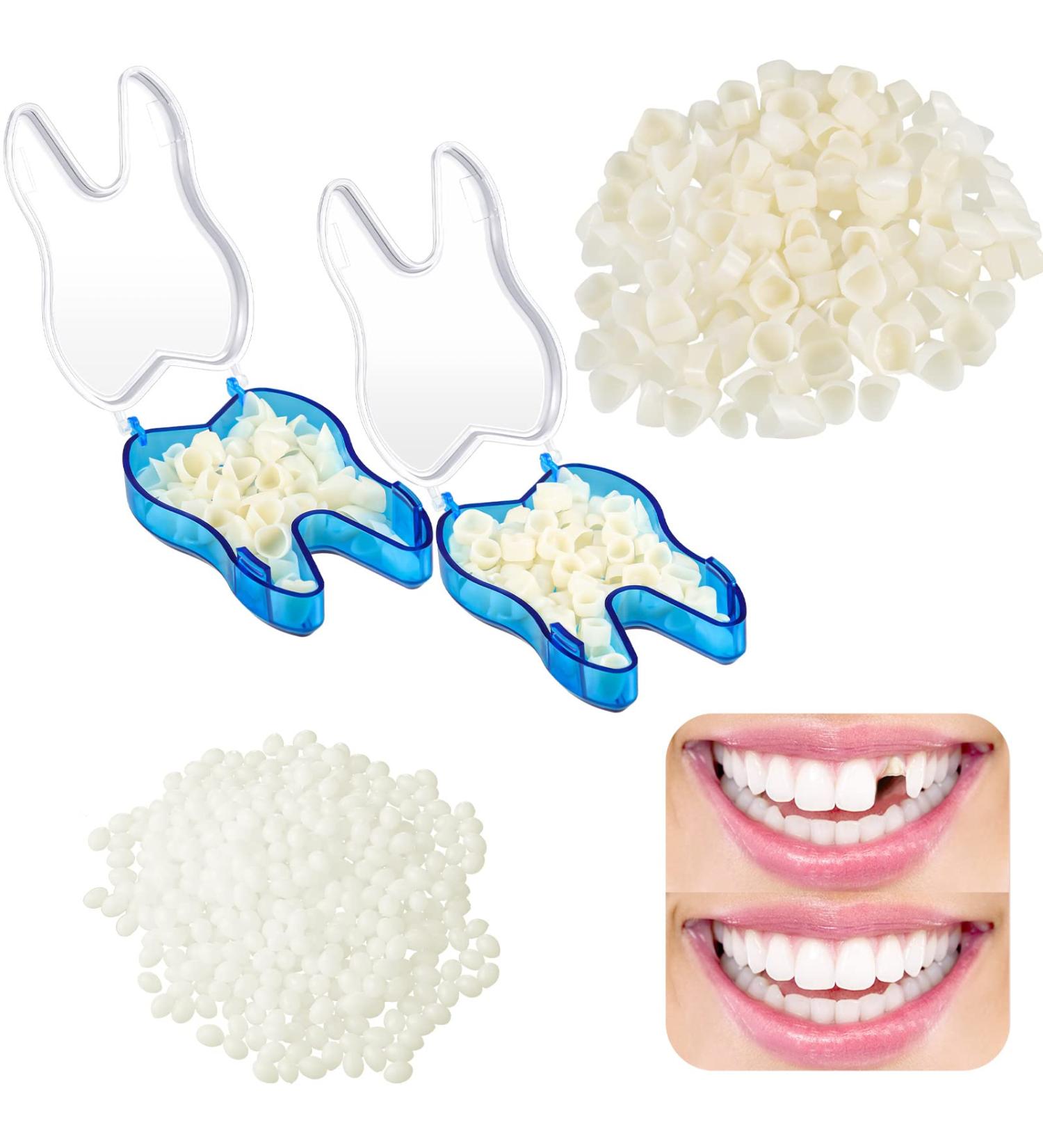 Temporary Tooth Replacement Kit - DIY Front Teeth Dental Veneer with Thermal Beads (100 Pieces) - Buy Online on GoSupps.com