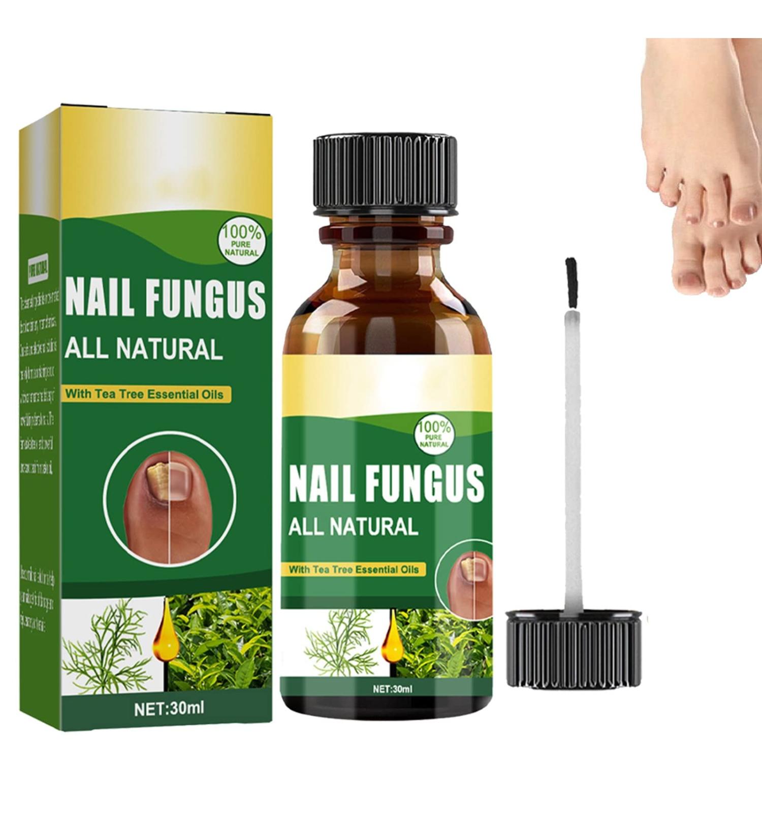 Antifungal Nail Treatment for Toe Fungus - 2-in-1 Solution to Treat and Prevent Nail Fungal Infections - Buy Online on GoSupps.com