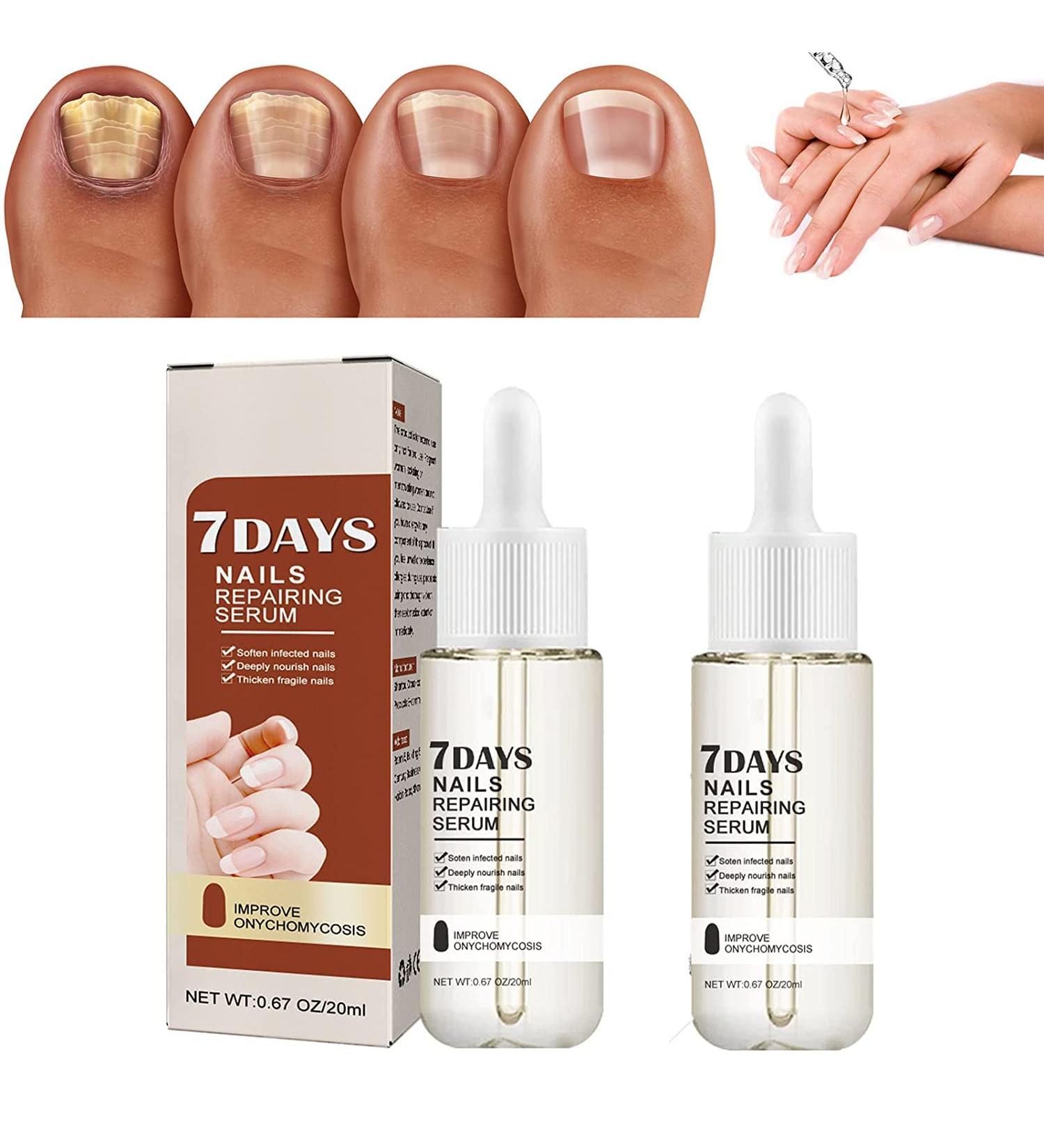 DUBUSH GFOUK 7 Days Nail Growth Power Serum Nail Cuticle Oil Strengthener 1 Week Nail Strengthening Treatment Make Nails Grow Stronger and Healthier 2pcs - Buy Online on GoSupps.com