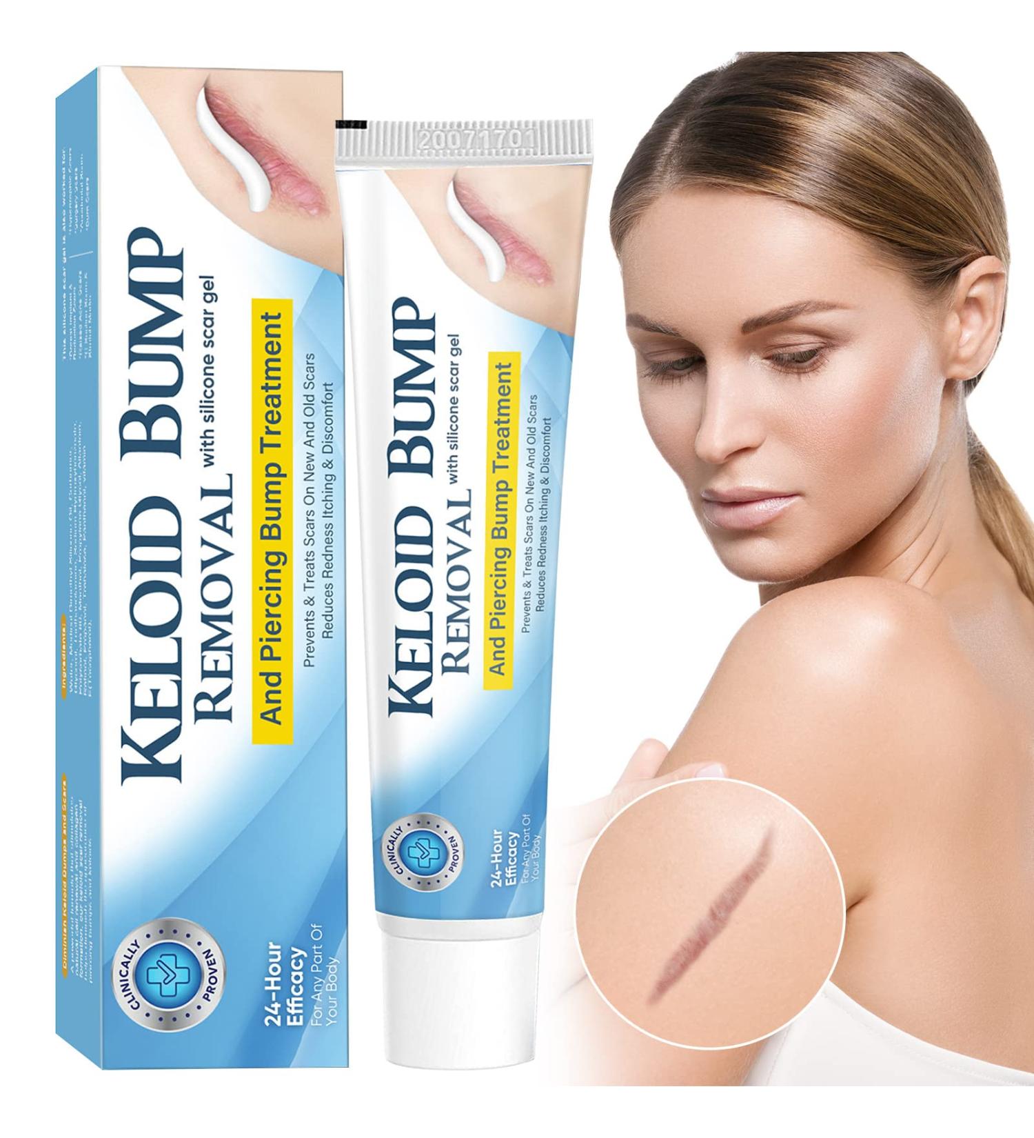 Advanced Silicone Scar Gel for Keloid Bump Removal & Treatment - Nose, Ear, Belly Piercings, Stretch Marks, Burn, Surgical, C-Section, Old & New Scars - Buy Online on GoSupps.com