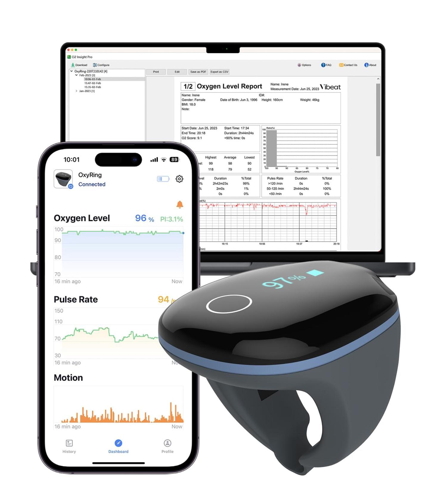 Vibeat OxyRing - Bluetooth Continuous Oxygen Monitor | Wearable Pulse Oximeter with Real-time Alerts & Free PC Reports for 16hrs Oxygen & Heart Rate Tracking - Buy Online on GoSupps.com