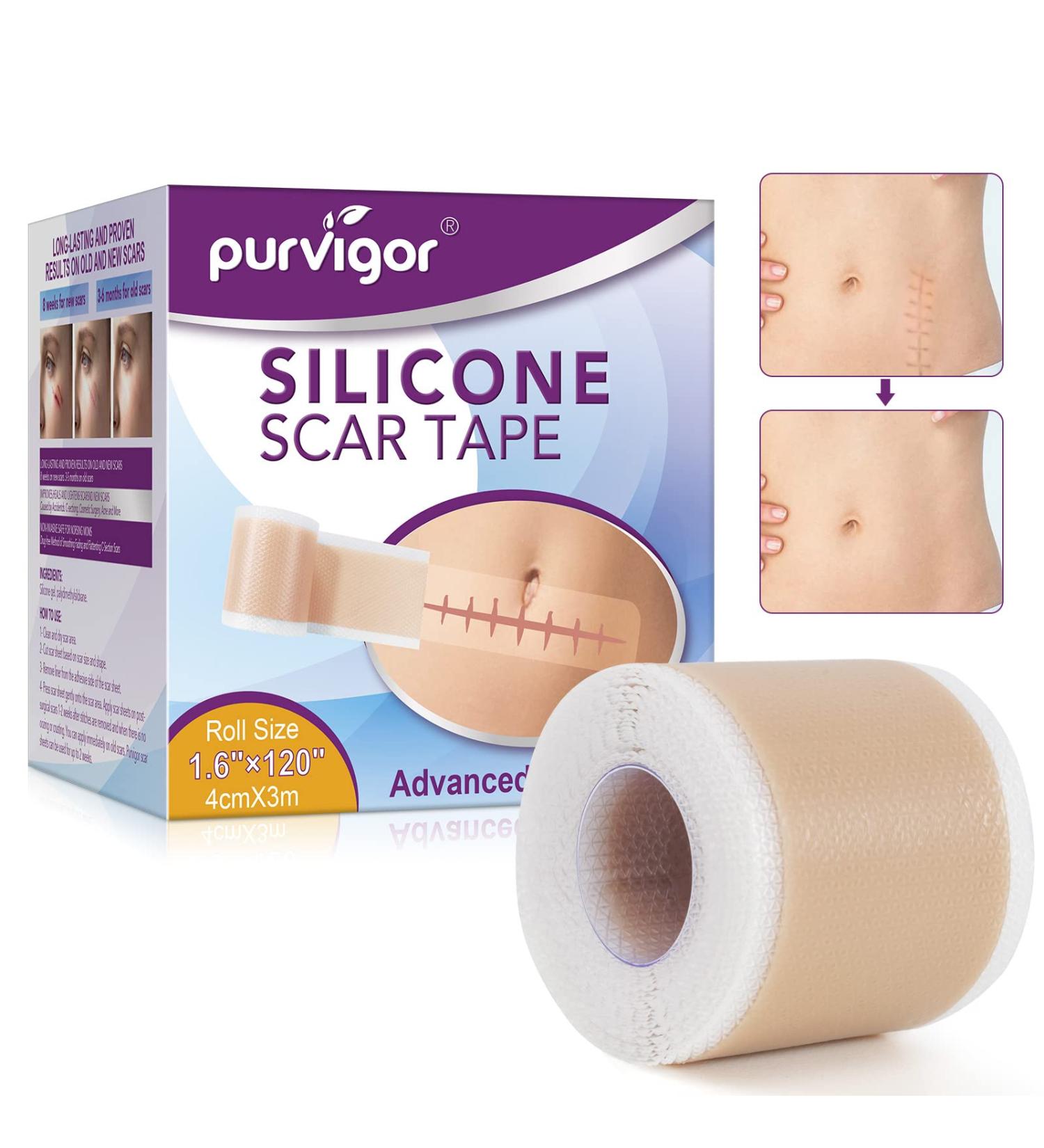 Soothing Silicone Scar Sheets Roll for C-Section, Surgery, Burns, Acne, Stretch Marks - 1.6 x 120 in - Reusable & Effective - Keloid Reduction - Buy Online on GoSupps.com