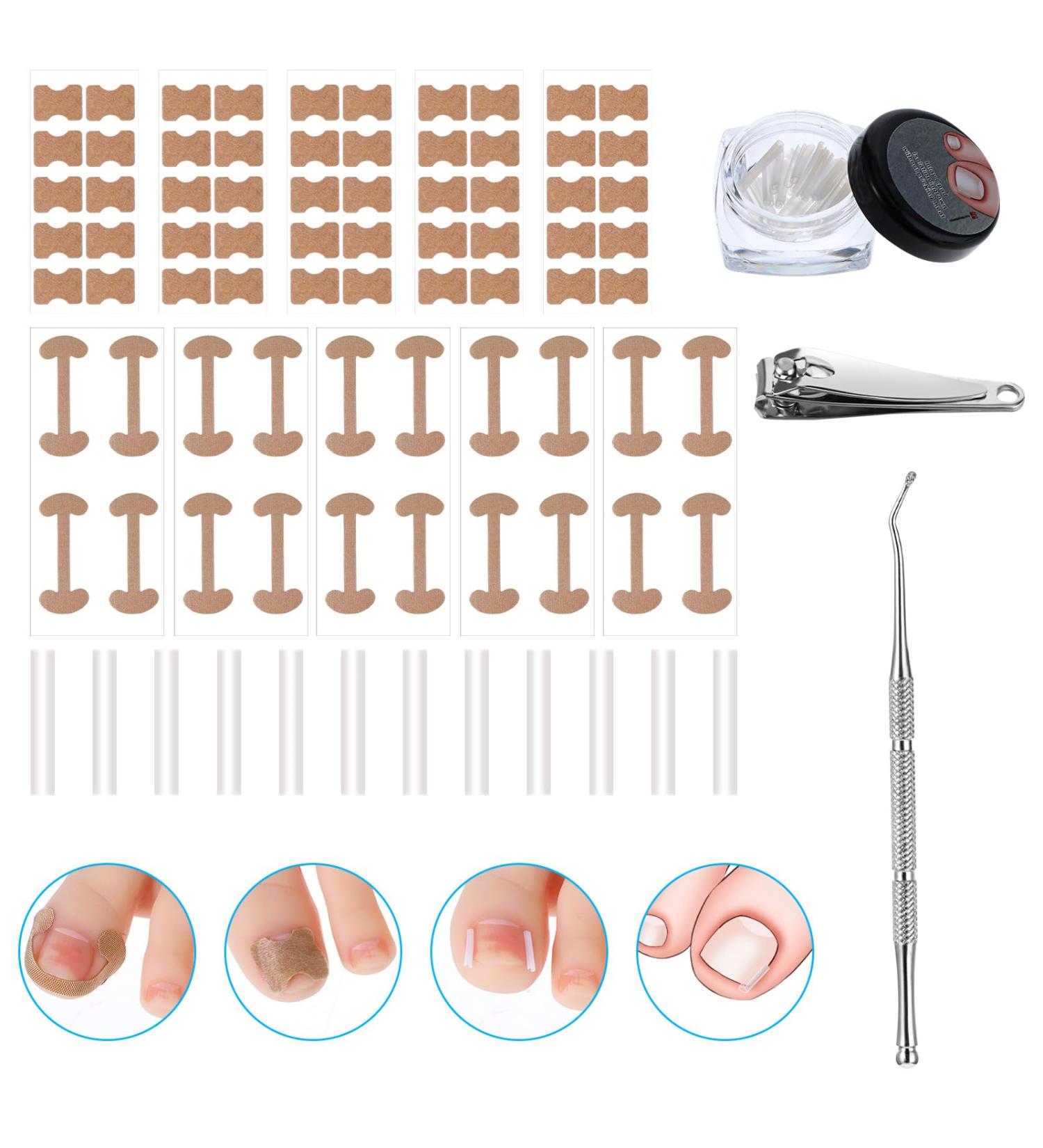 Jeffdad Ingrown Toenail Treatment Kit | Professional Removal & Correction | Lifter & Clipper Included | Quick & Effective Nail Repair - Buy Online on GoSupps.com