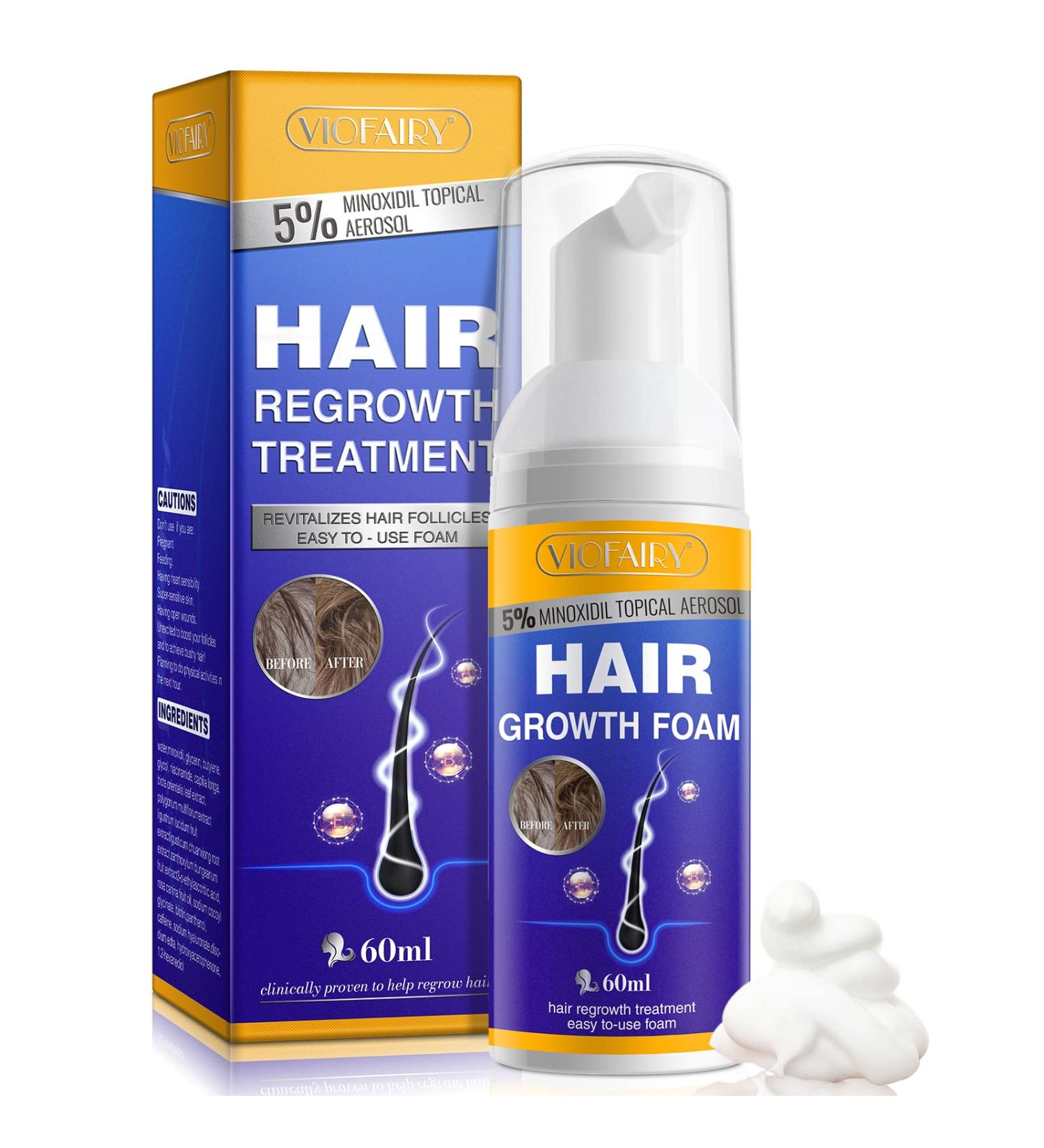 5% Minoxidil Hair Growth Foam for Men and Women - Stop Thinning Hair - Hair Loss Treatment - Stronger, Thicker, Longer Hair - Buy Online on GoSupps.com