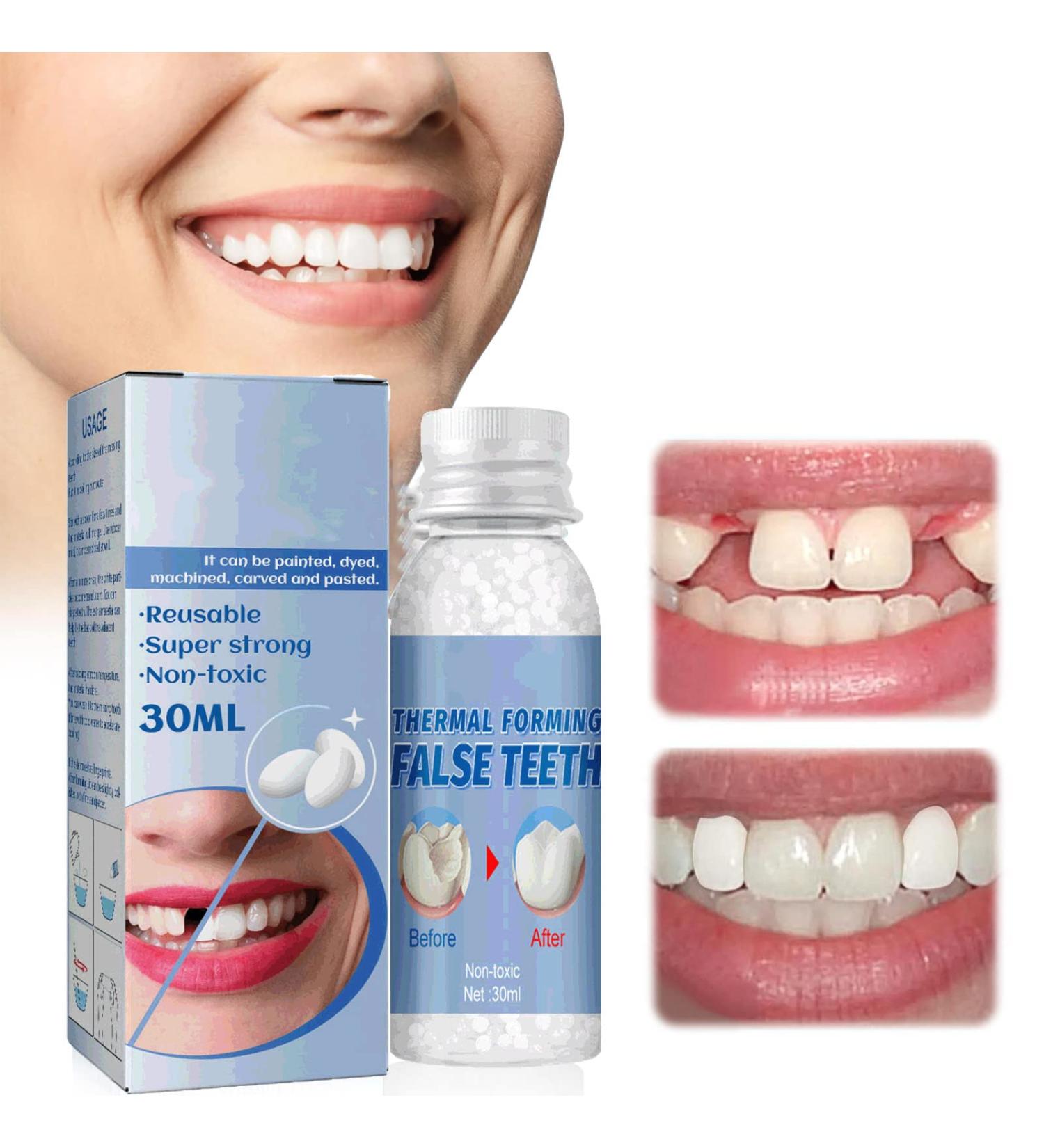 WTTFC Temporary Tooth Repair Pearls - DIY Tooth Filling Material for Missing Teeth | 60g Tooth Repair Set Easy to Use and Heat Conductor - Buy Online on GoSupps.com