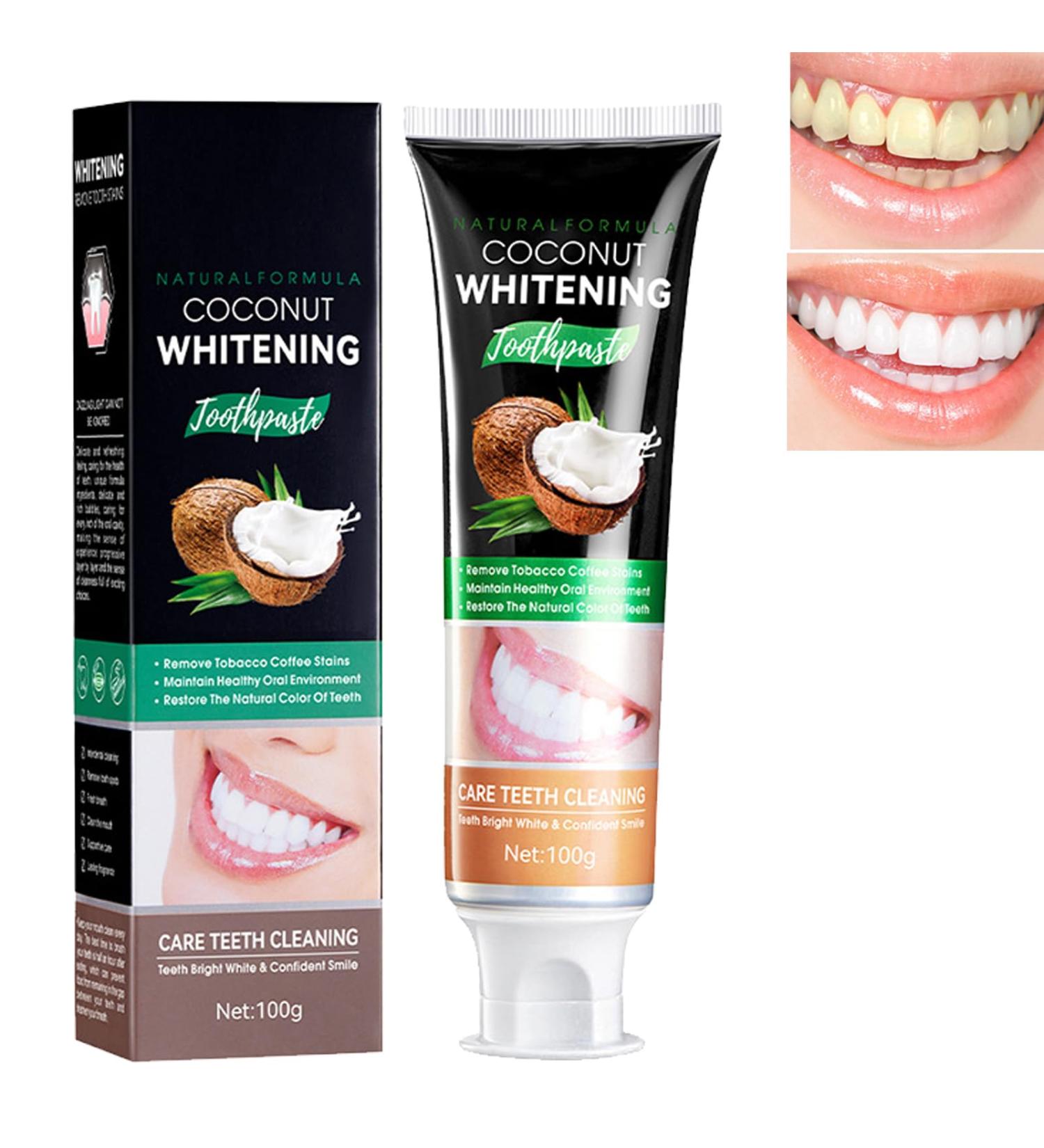 Koahde Coconut Oil Toothpaste - Natural Whitening 100g | Lighten Teeth & Refresh Smile - Buy Online on GoSupps.com