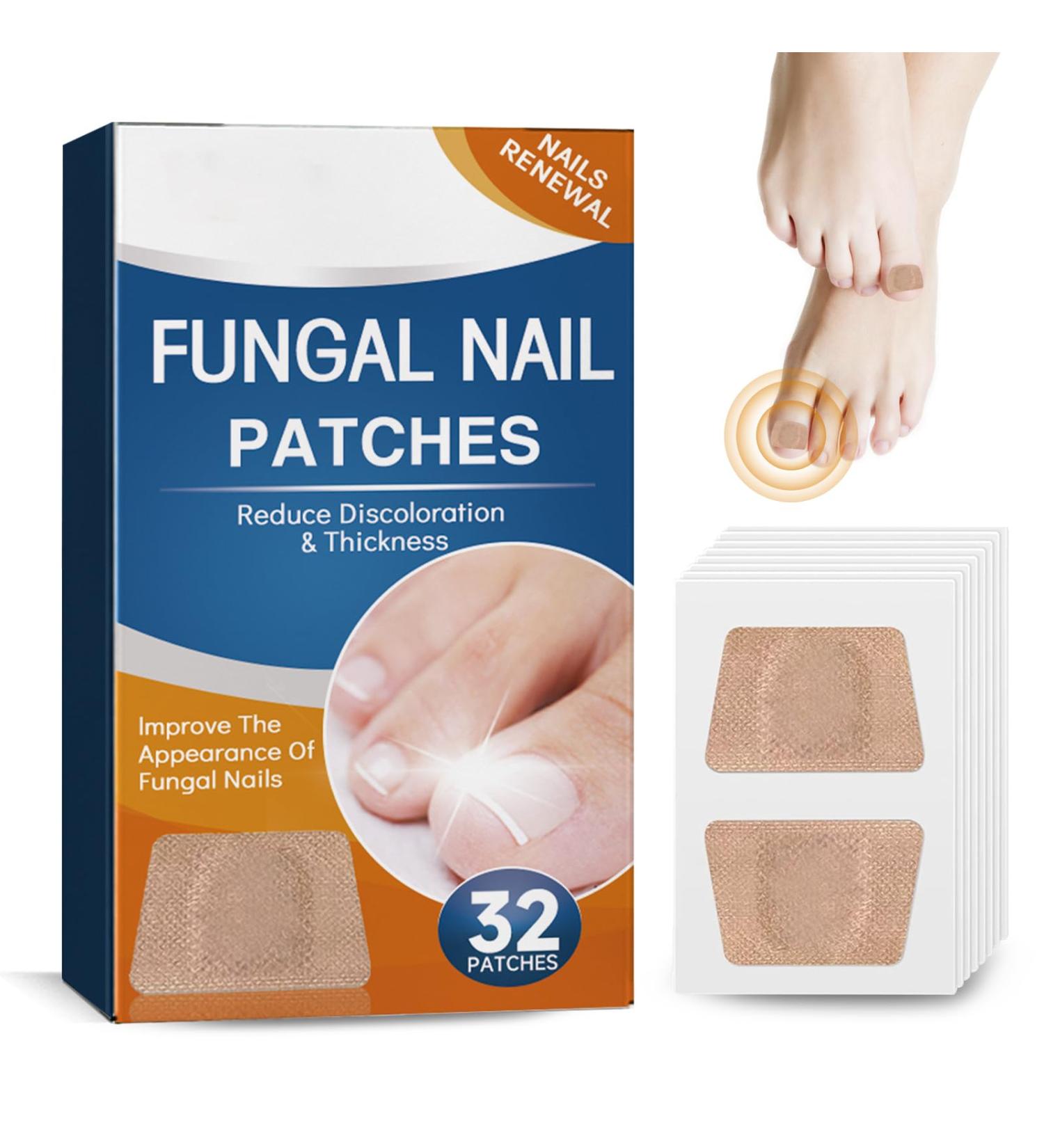 Roser 32 Piece Toenail Correction Patch | Nail Repair & Strengthening for Damaged & Discolored Nails - Buy Online on GoSupps.com