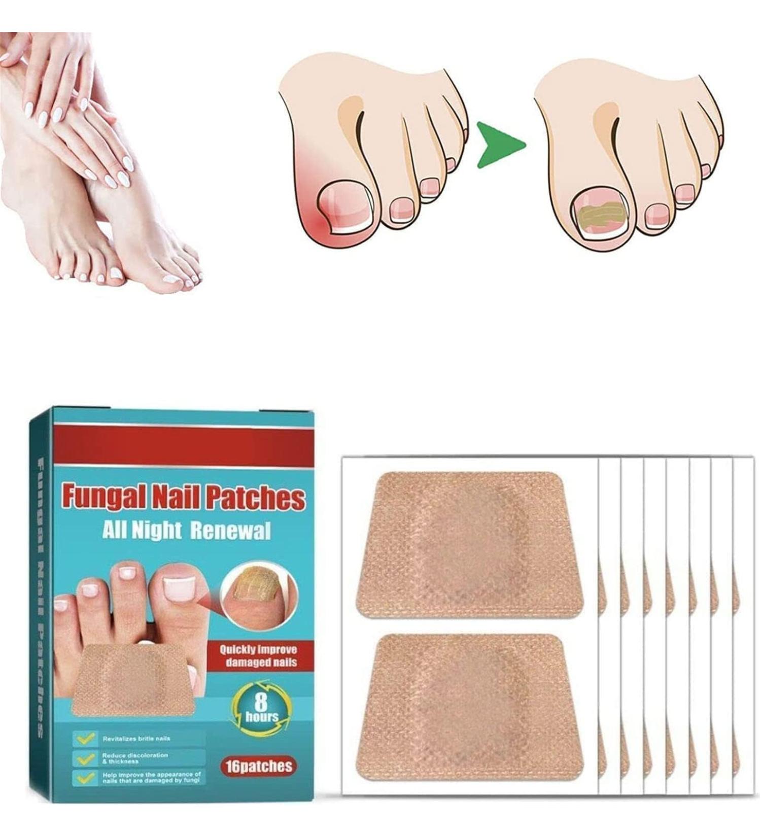 (Most Gifted) 2024 New 3Box/48pcs Anti F-ungal Nail T-reatment P-atches Toe F-ungus O-nychomycosis Repair S-Ticker - Buy Online on GoSupps.com