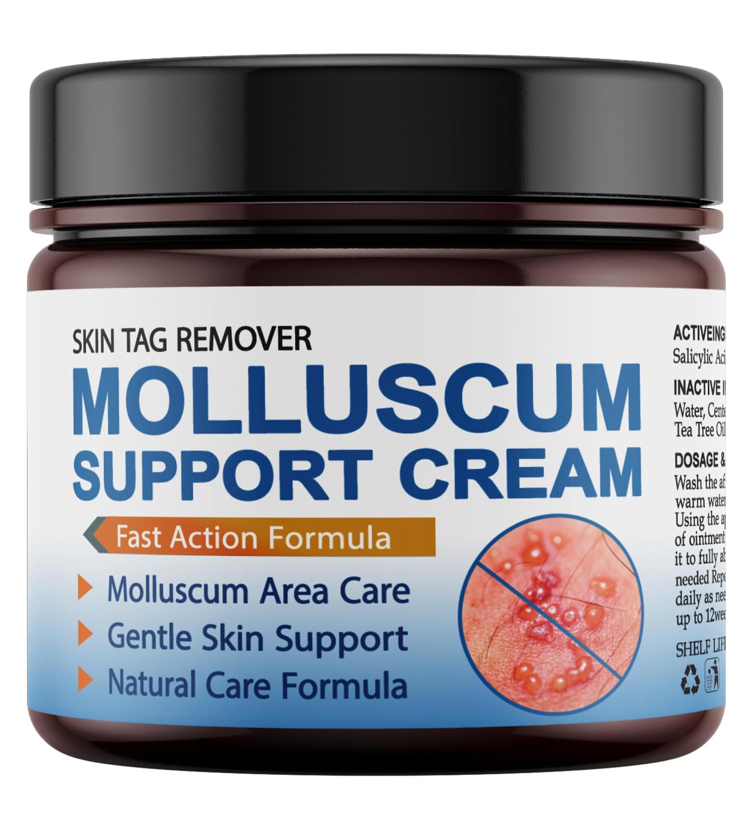 NateNatenight Molluscum Support Treatment Molluscum Support Cream All Natural Support Cream for Molluscum Rash 30g - Buy Online on GoSupps.com
