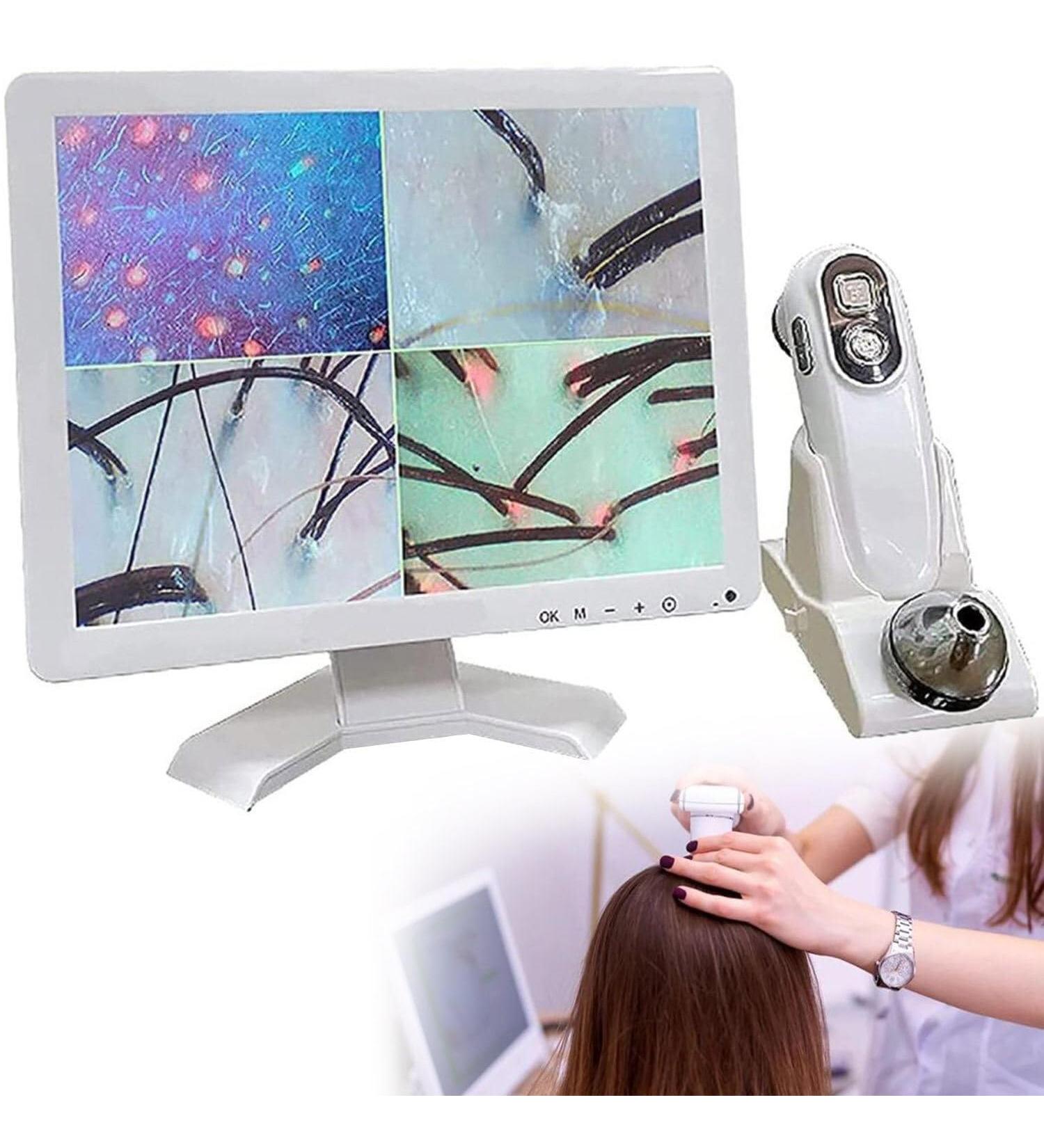 SDTOOP 15.5 Inch HD LCD Screen Microscope Tester for Hair Follicles Facial Skin Oil Moisture Health Detection Machine for Home Salon Use - Buy Online on GoSupps.com