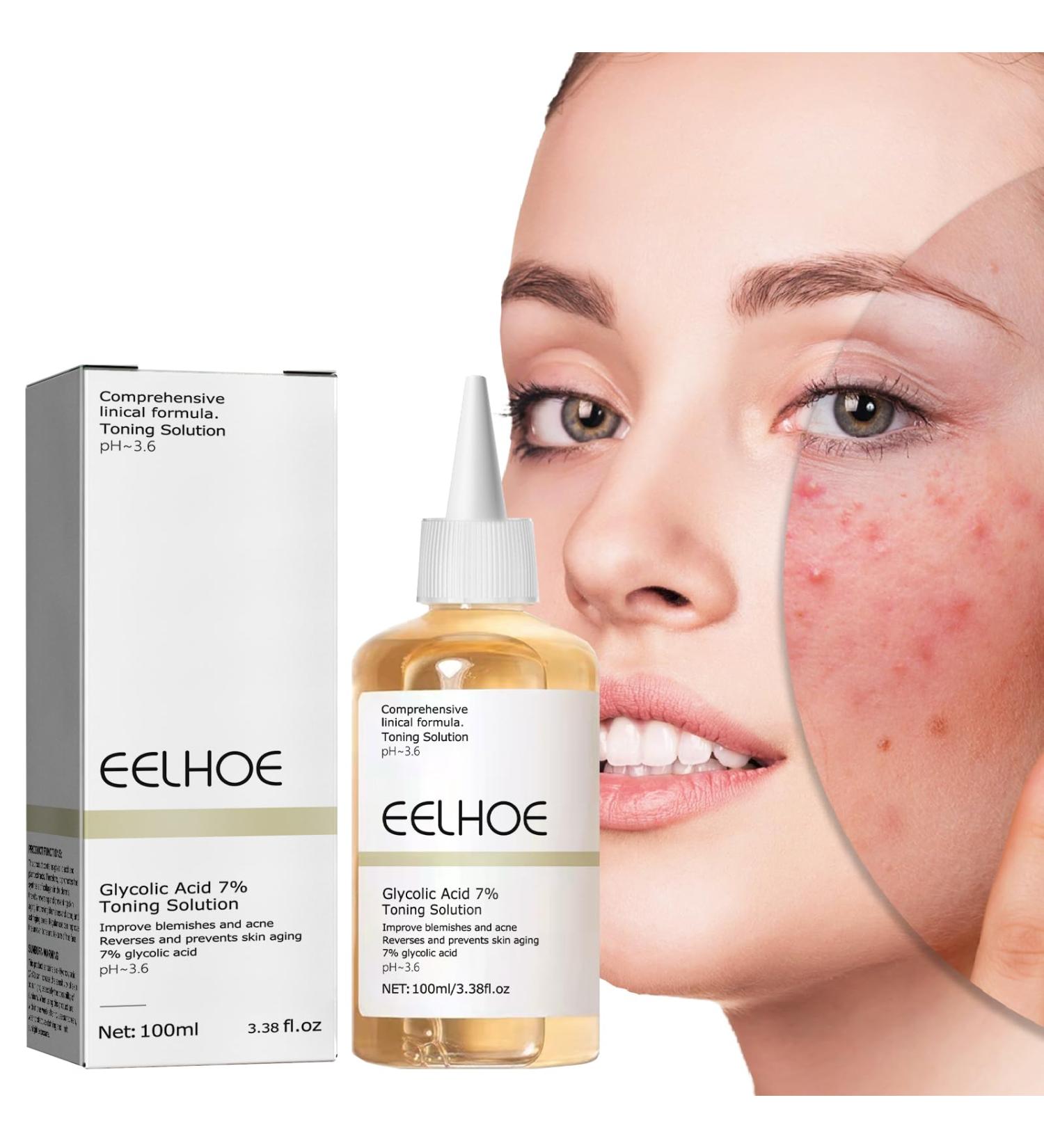 Glycolic Acid 7% Toner Glycolic Acid Toner for Face Repair Acne & Anti Aging Face Toner - Brightening & Facial Exfoliation Prevent Skin AgingImprove Blemishes Astringe Pores 1# - Buy Online on GoSupps.com