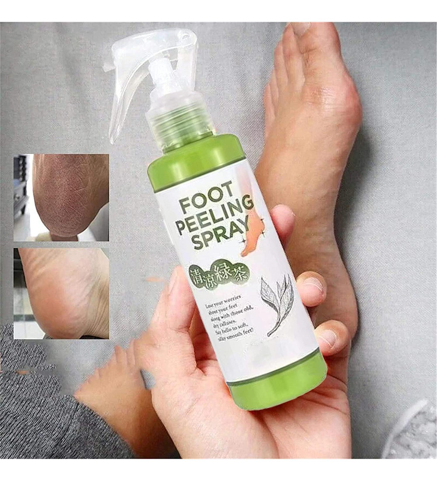 Foot Peeling Spray Orange Oil Foot Peeling Spray That Remove Dead Skin Tea Tree Foot Peeling Spray Remove Dead Skin within Seconds Exfoliator For Cracked Rough Heels Dry Toe Skin&Calluses (Green) - Buy Online on GoSupps.com